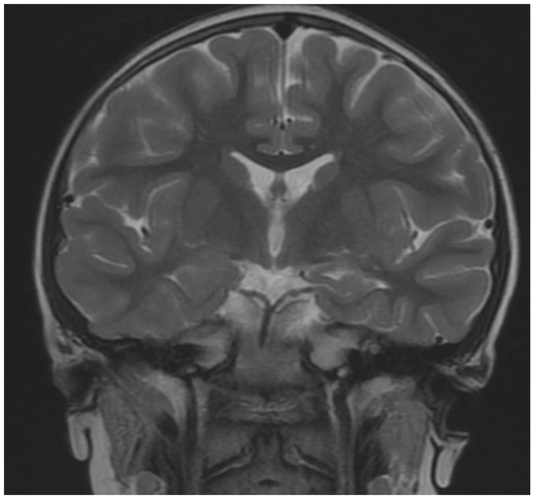 Brainsci 12 00390 g001