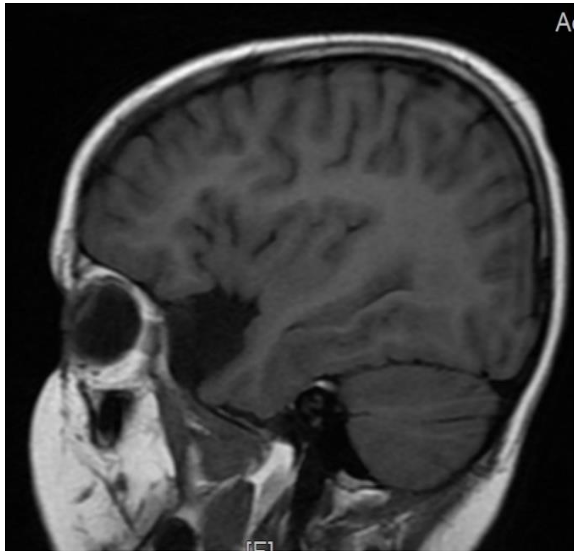 Brainsci 12 00390 g003