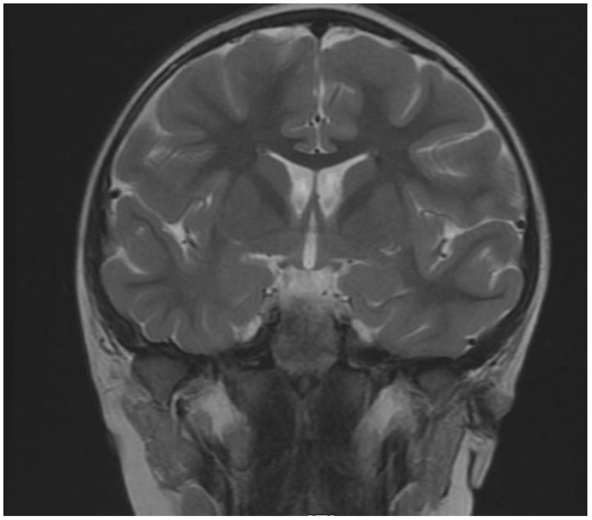 Brainsci 12 00390 g004