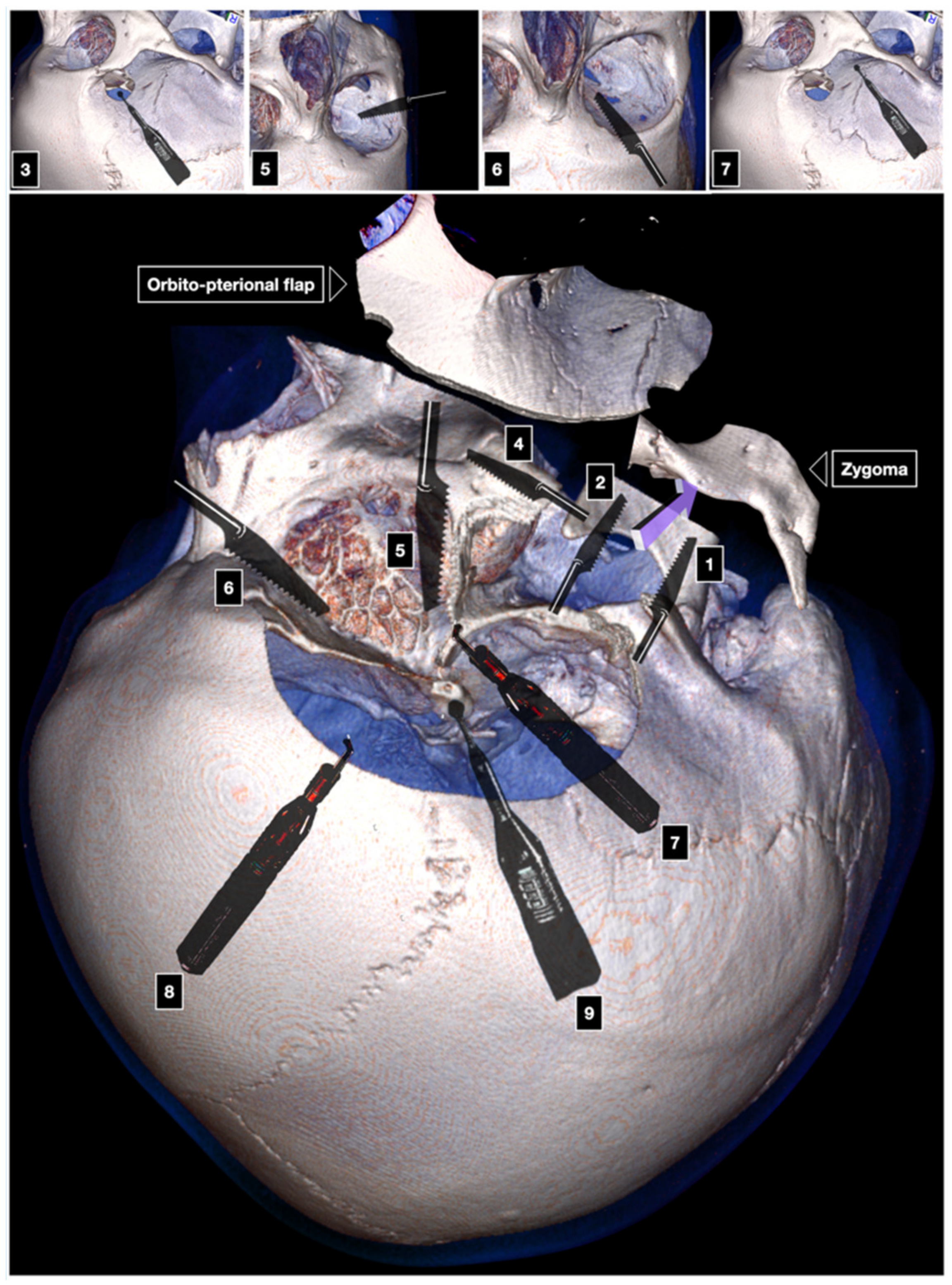 Brainsci 12 00405 g005