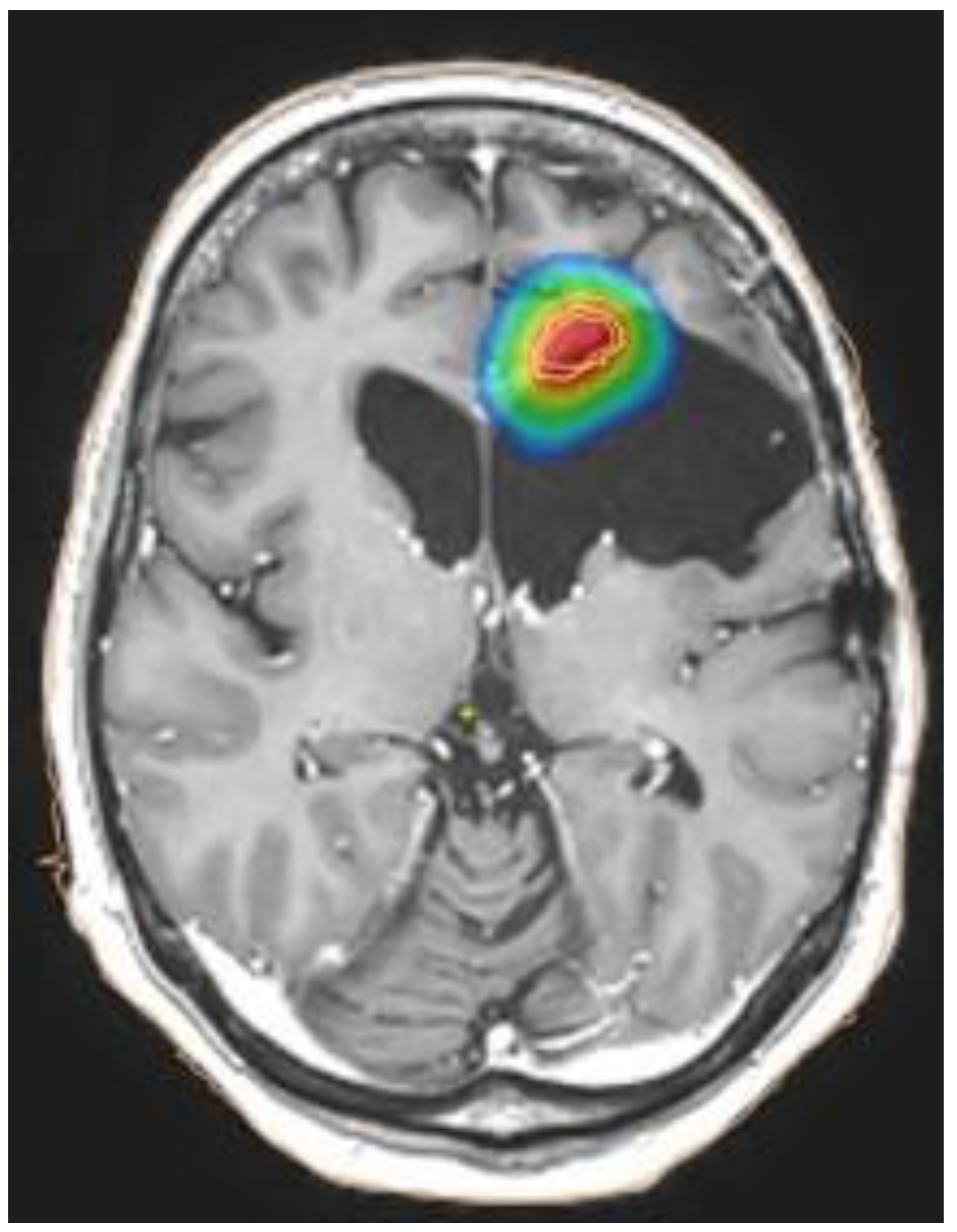 Brainsci 12 00416 g002