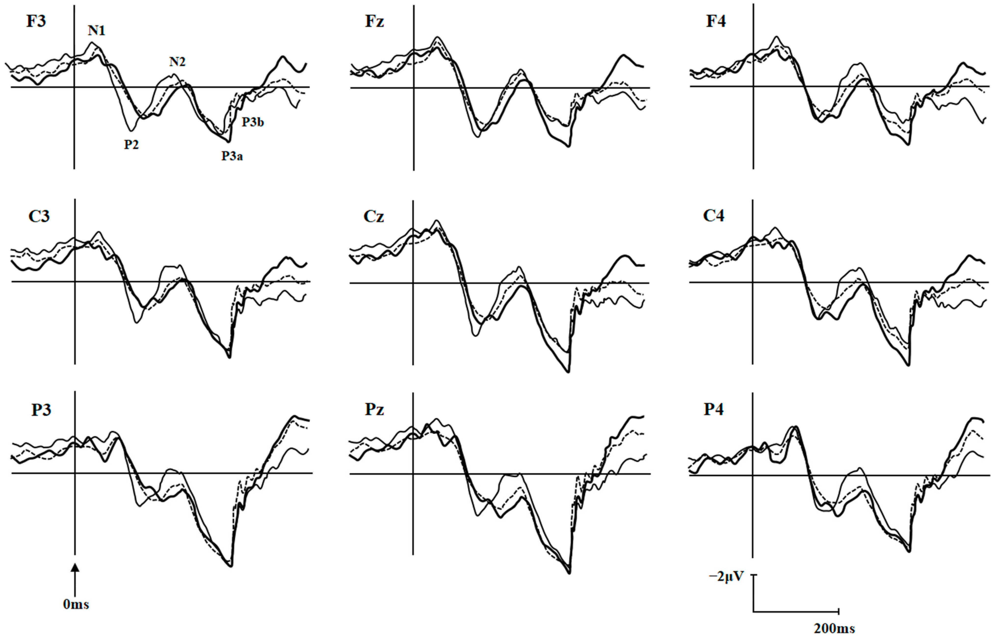 Brainsci 12 00441 g002