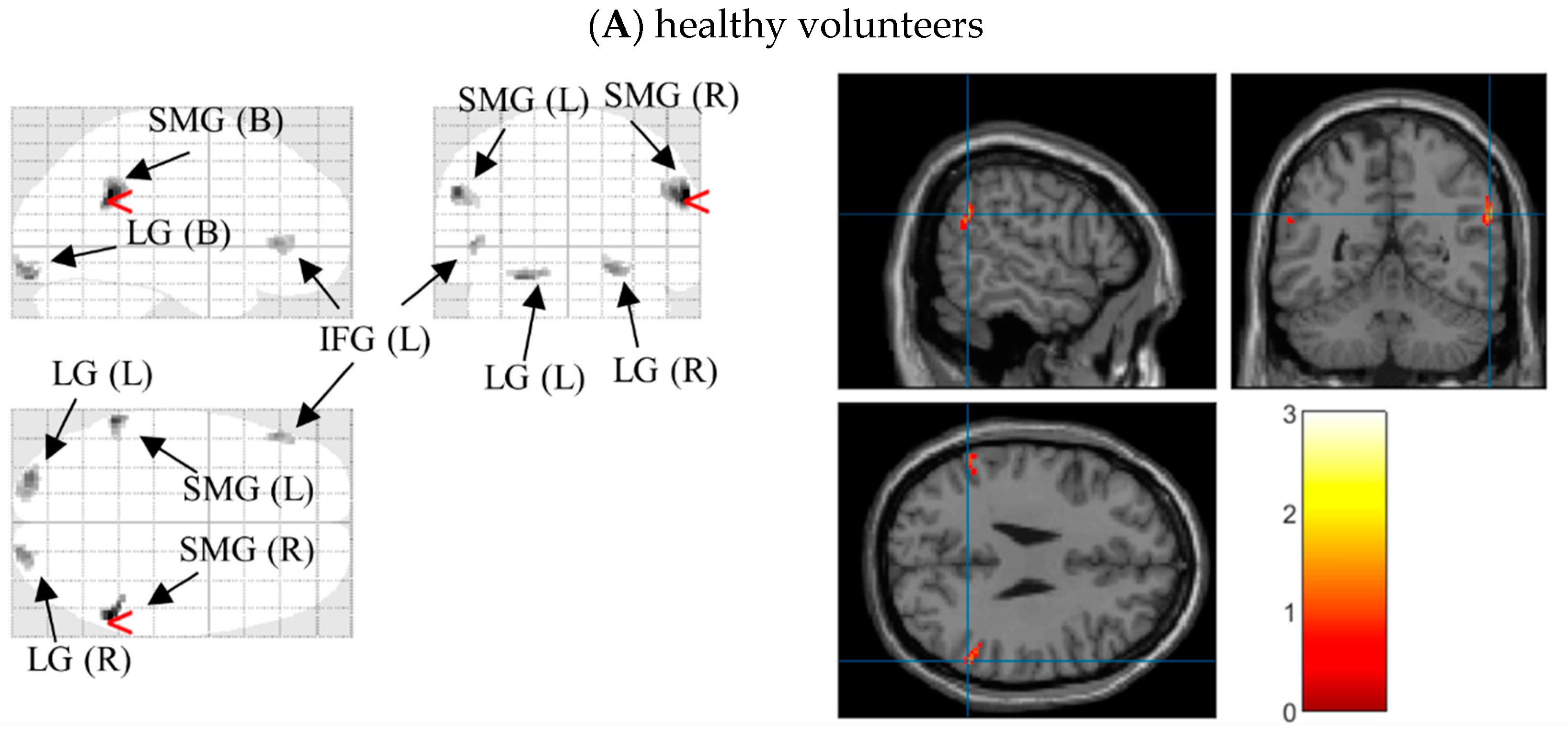 Brainsci 12 00441 g004a