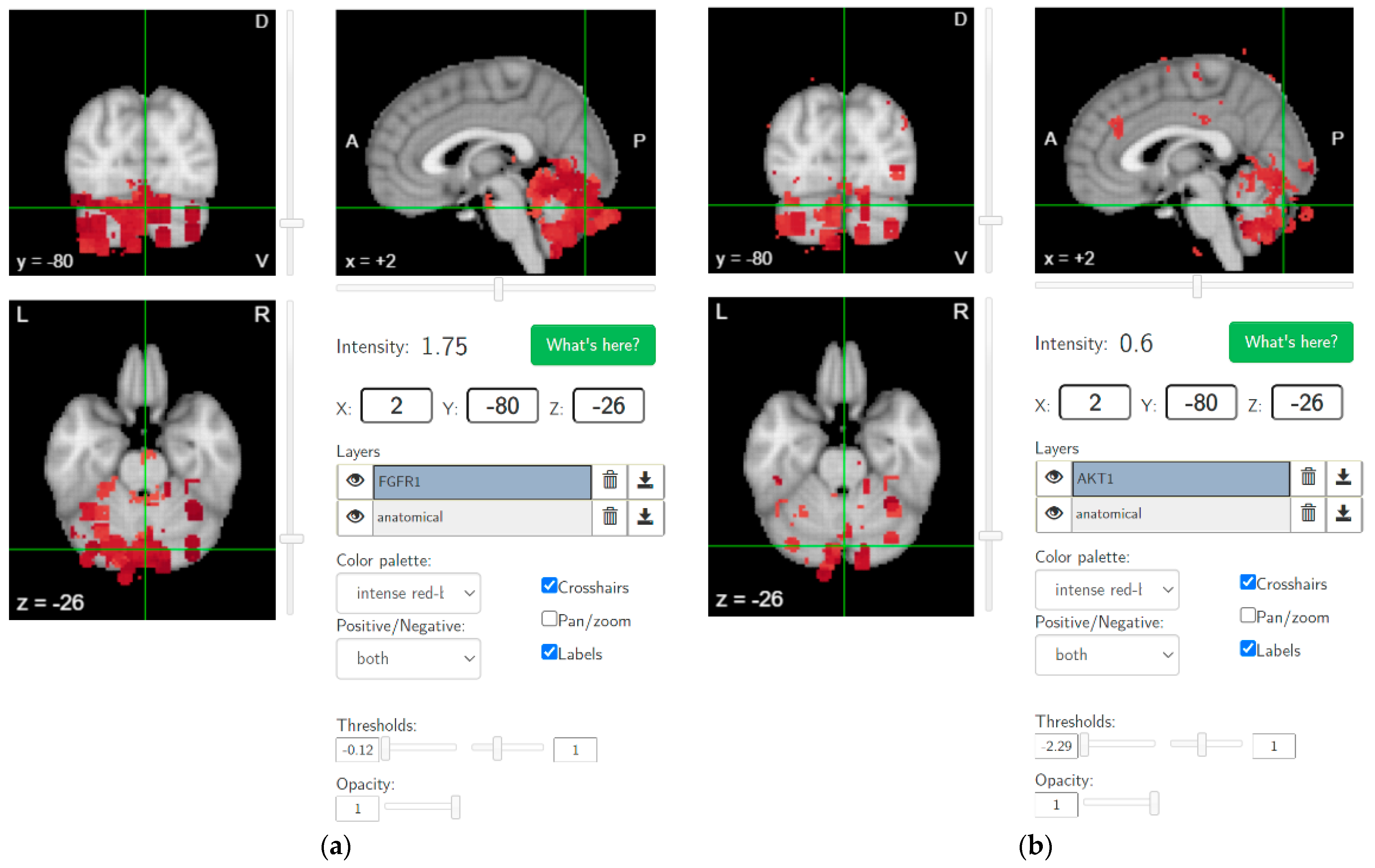 Brainsci 12 00445 g004 Brainsci 12 00445 g004