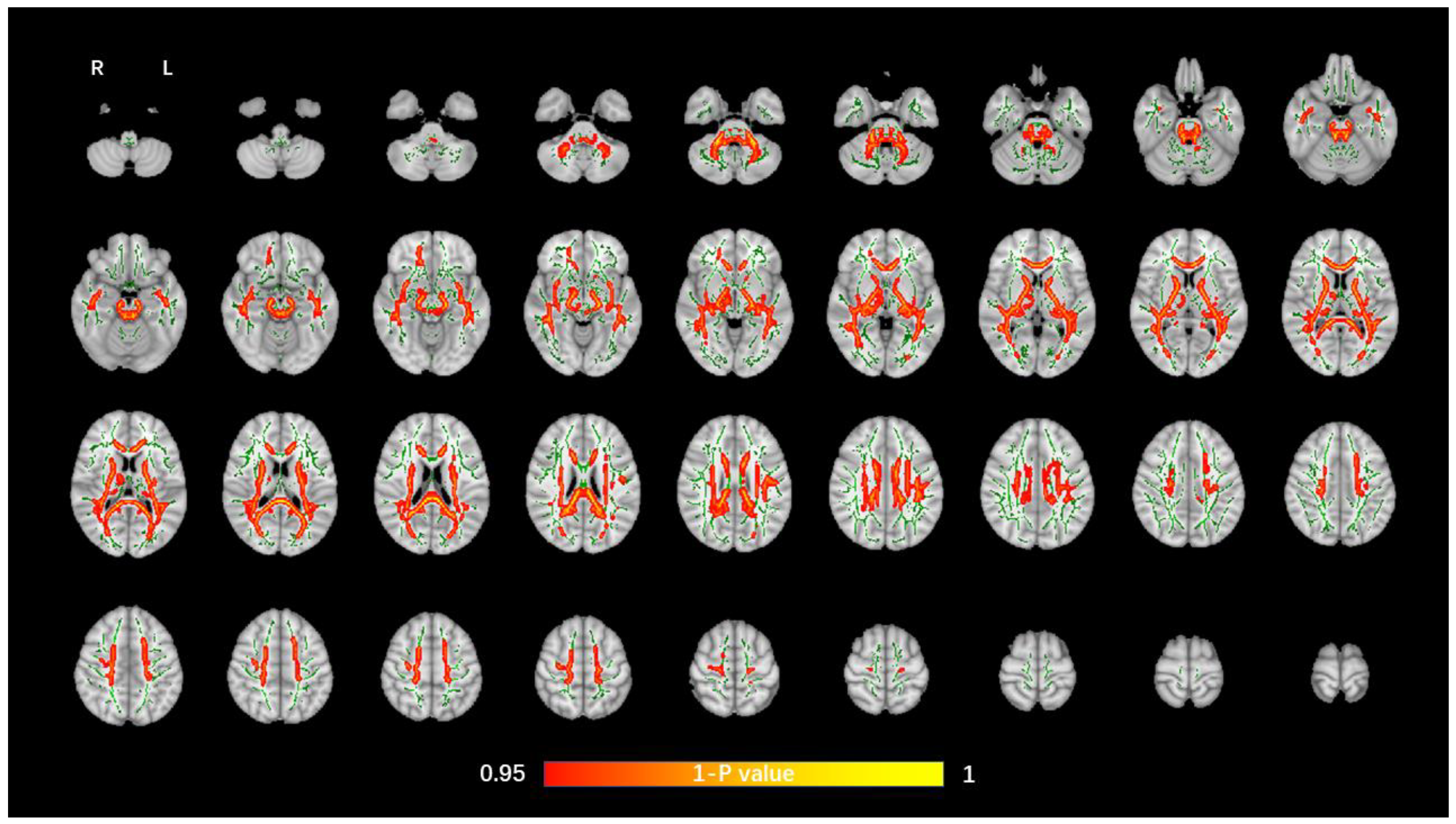 Brainsci 12 00482 g001