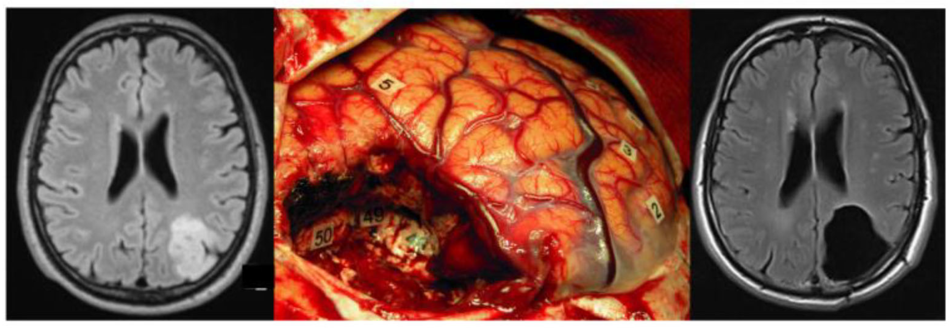 Brainsci 12 00504 g001