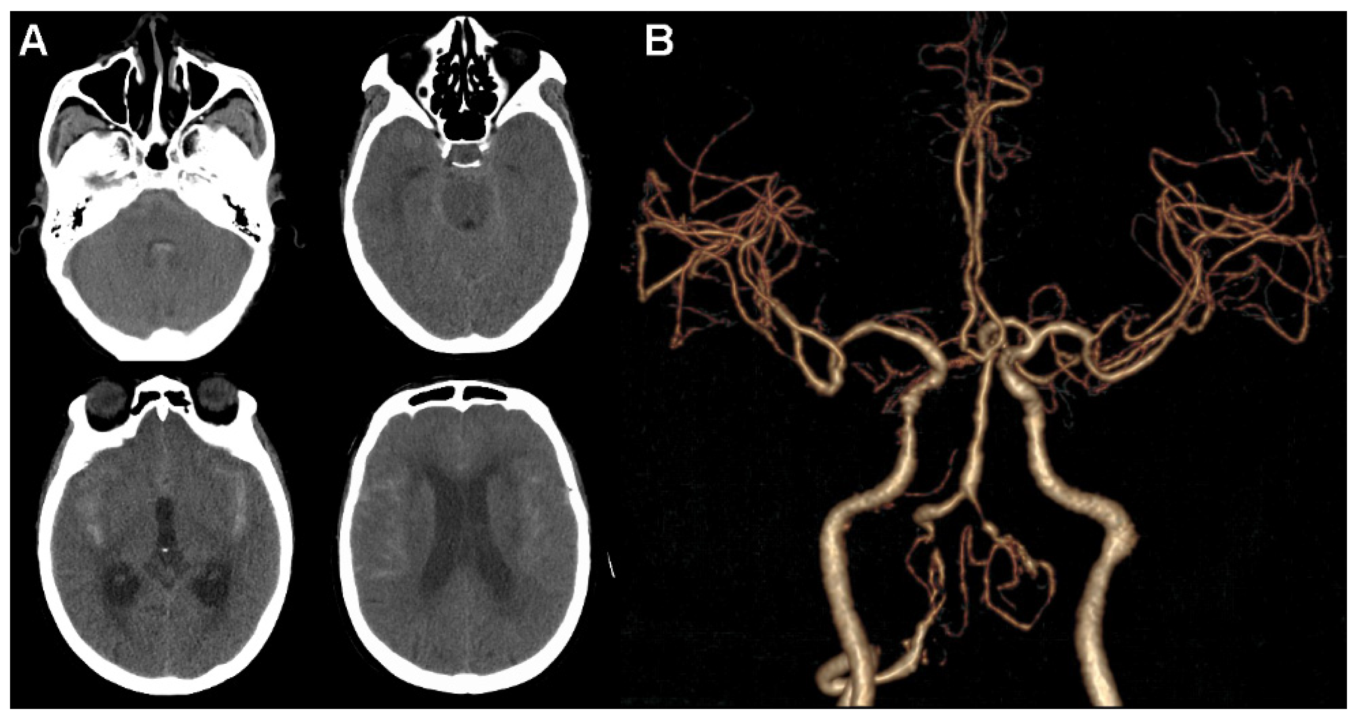 Brainsci 12 00519 g001 Brainsci 12 00519 g001