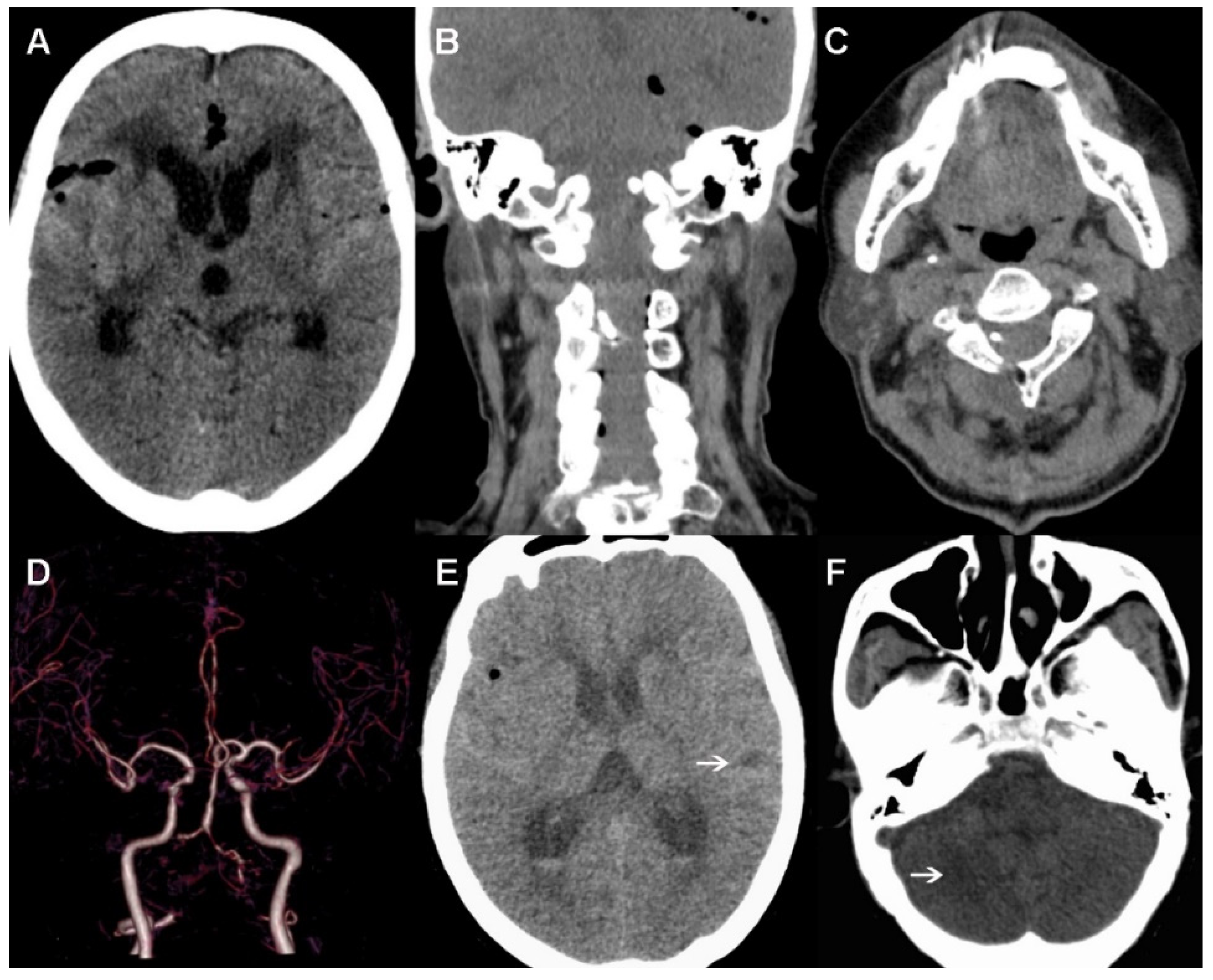 Brainsci 12 00519 g004 Brainsci 12 00519 g004