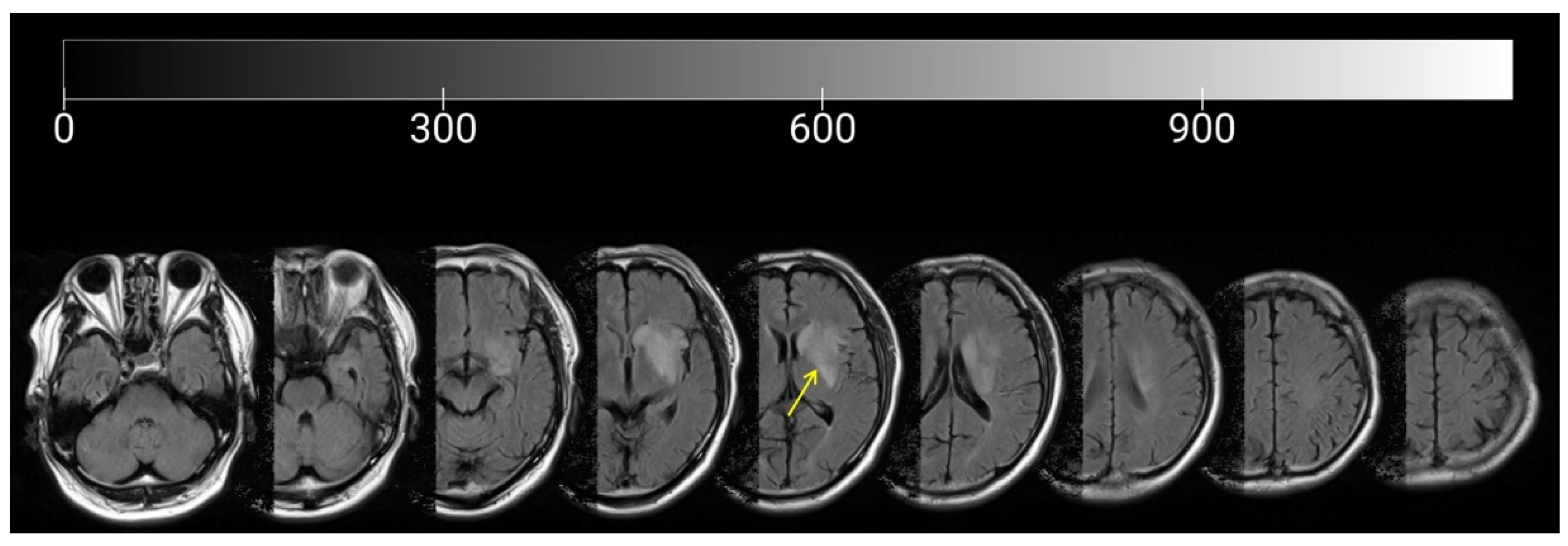 Brainsci 12 00540 g001 Brainsci 12 00540 g001