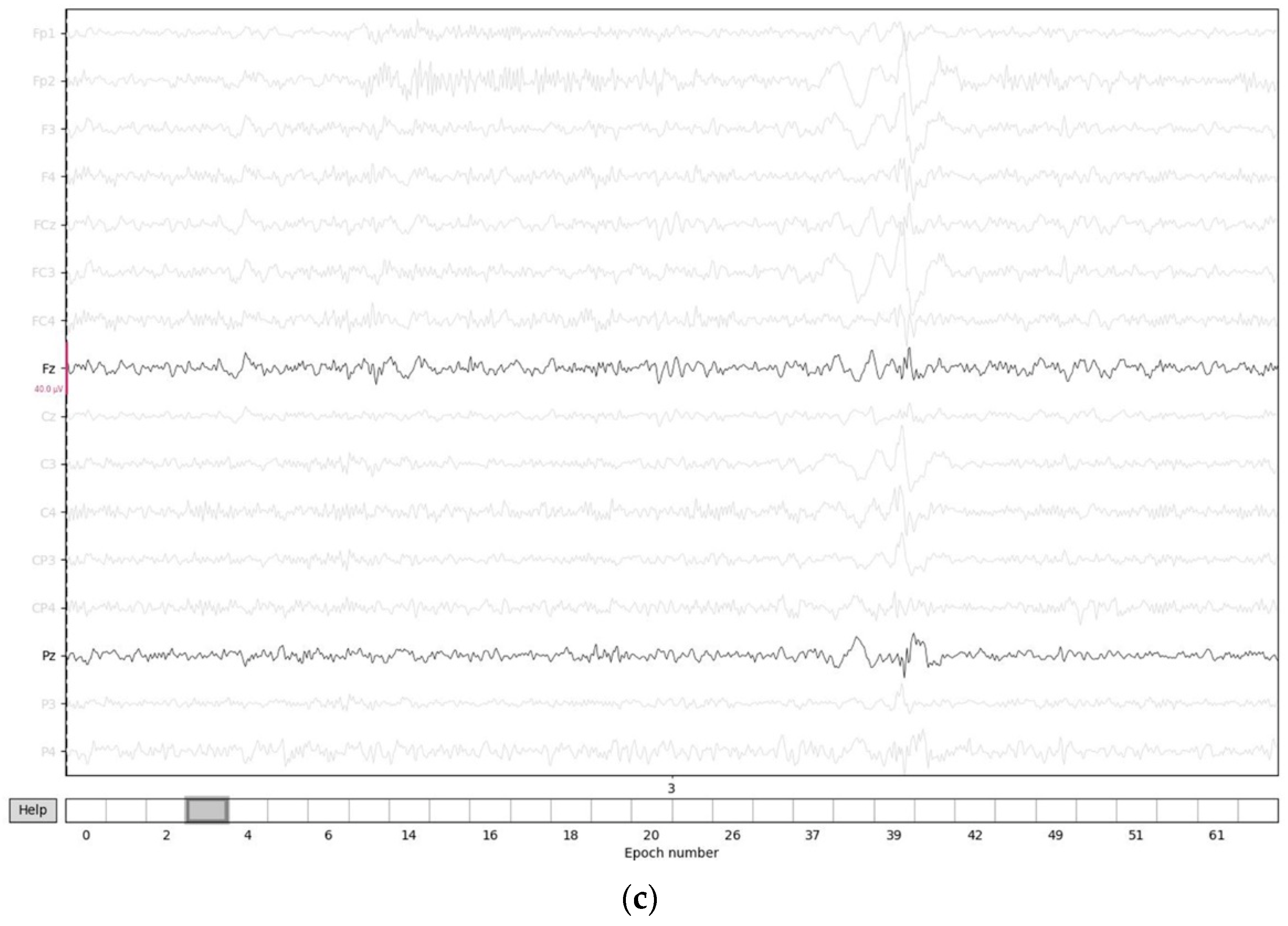 Brainsci 12 00664 g002b Brainsci 12 00664 g002b