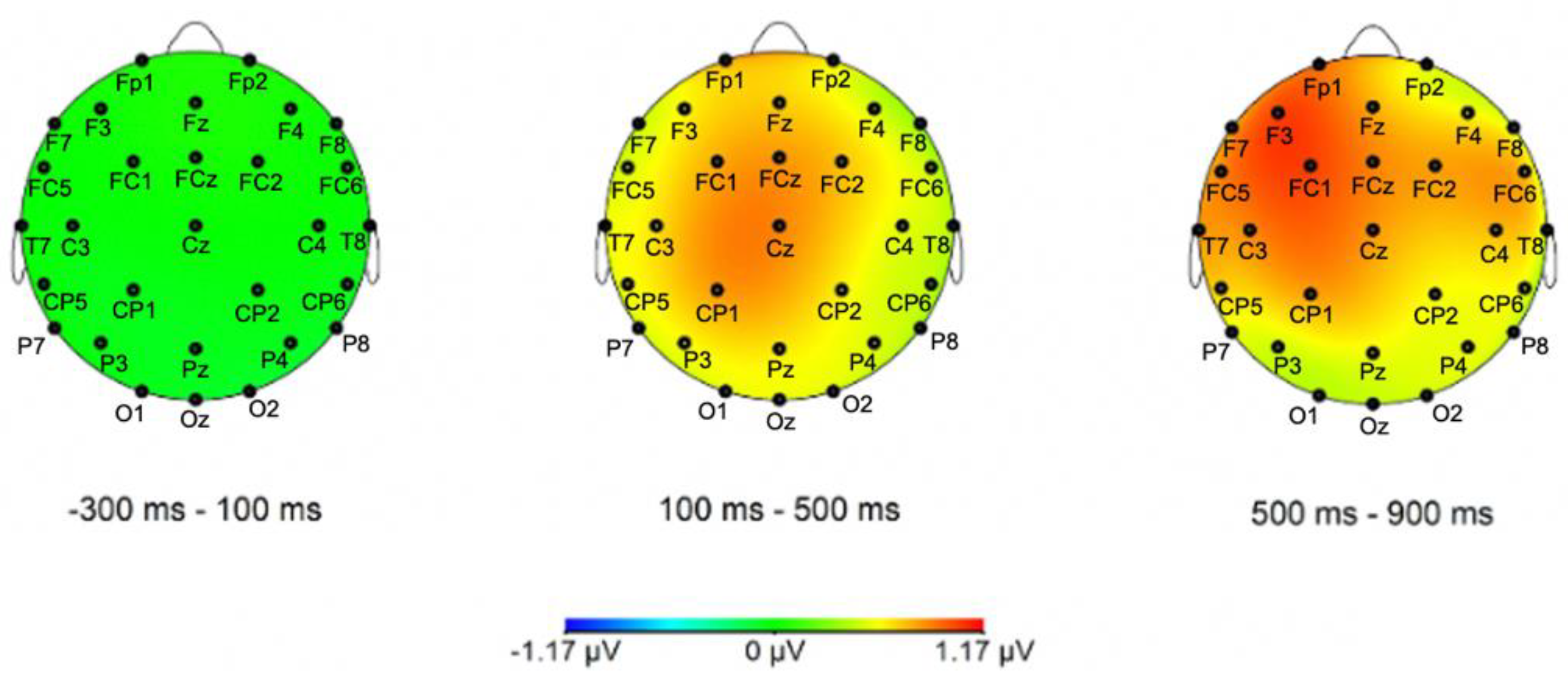 Brainsci 12 00669 g006