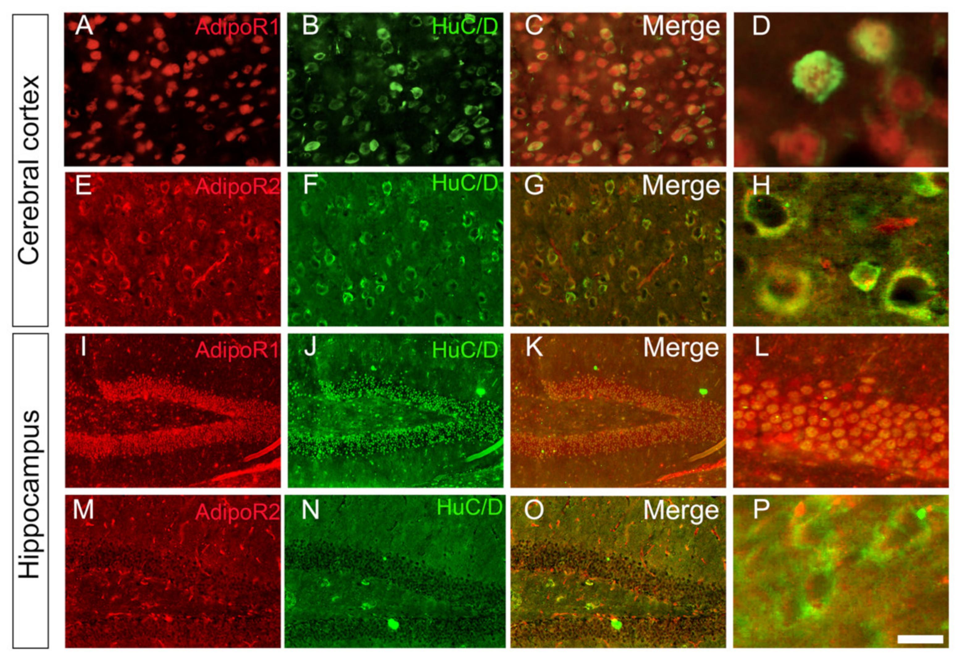 Brainsci 12 00680 g002 Brainsci 12 00680 g002