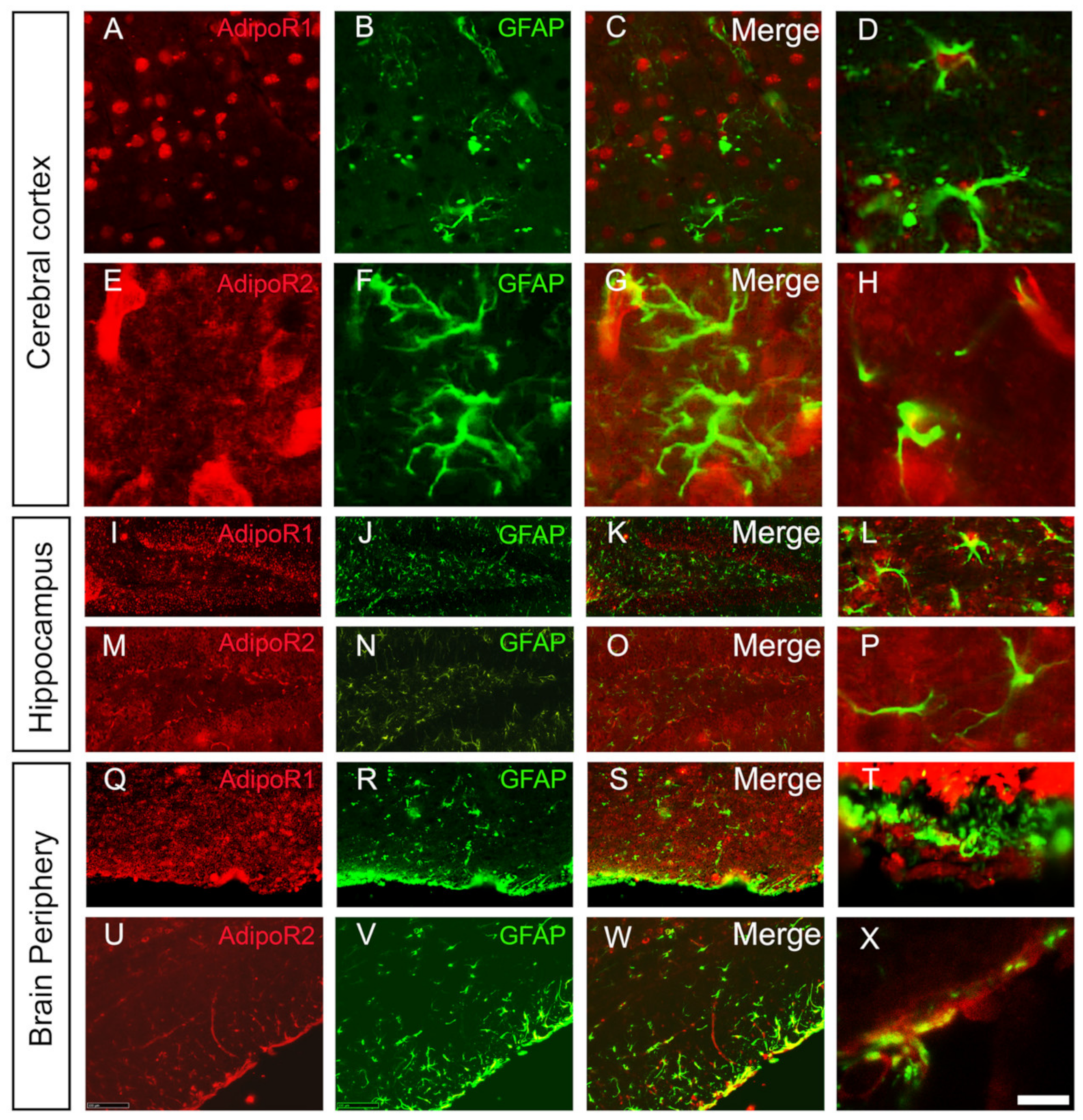 Brainsci 12 00680 g004 Brainsci 12 00680 g004
