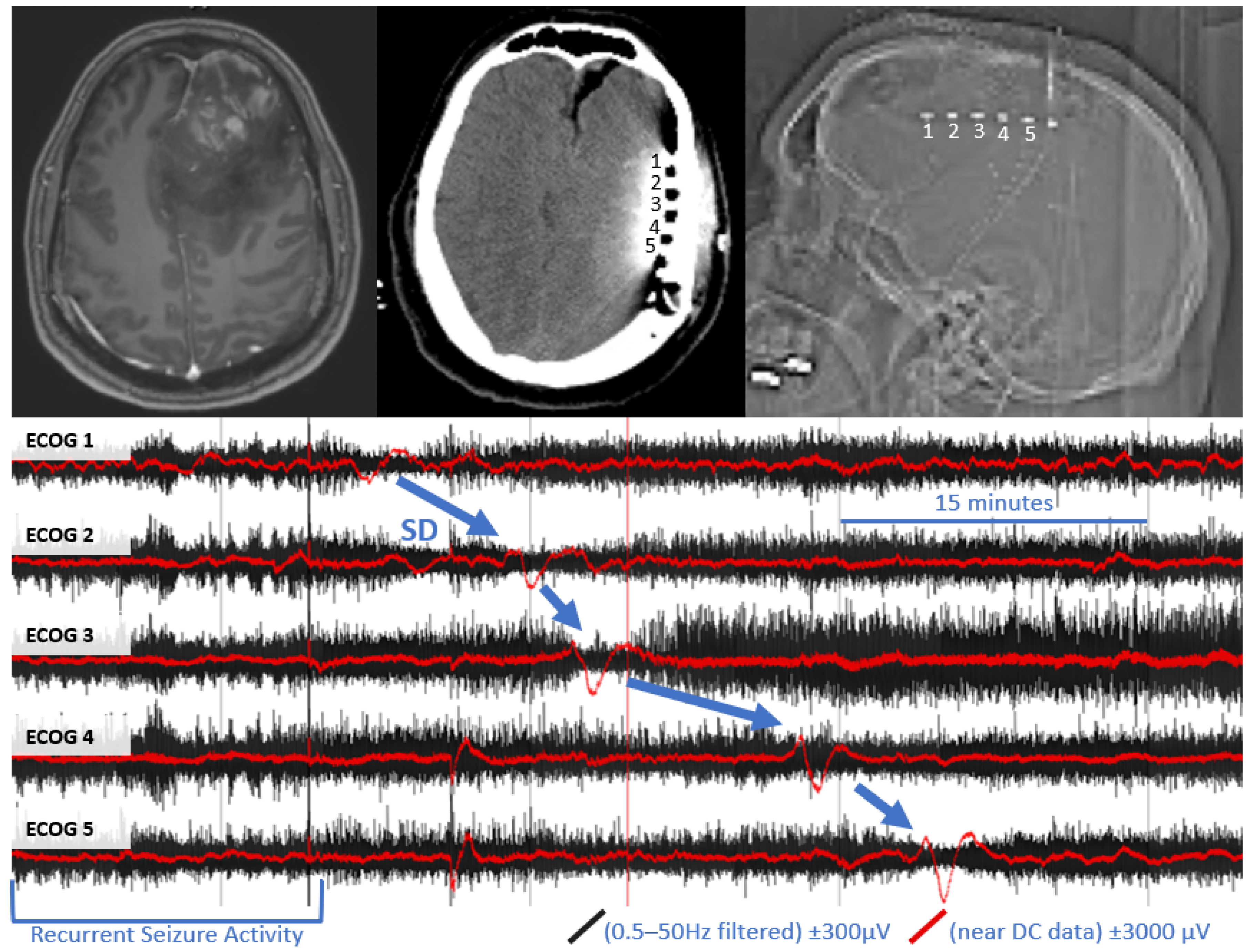 Brainsci 12 00710 g001