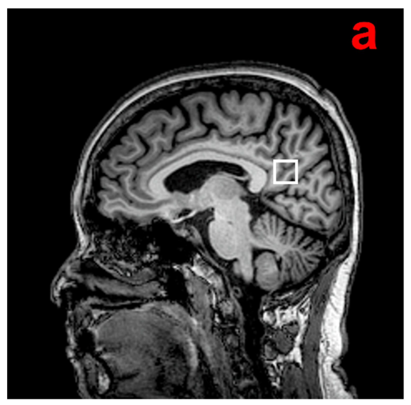 Brainsci 12 00722 g001a