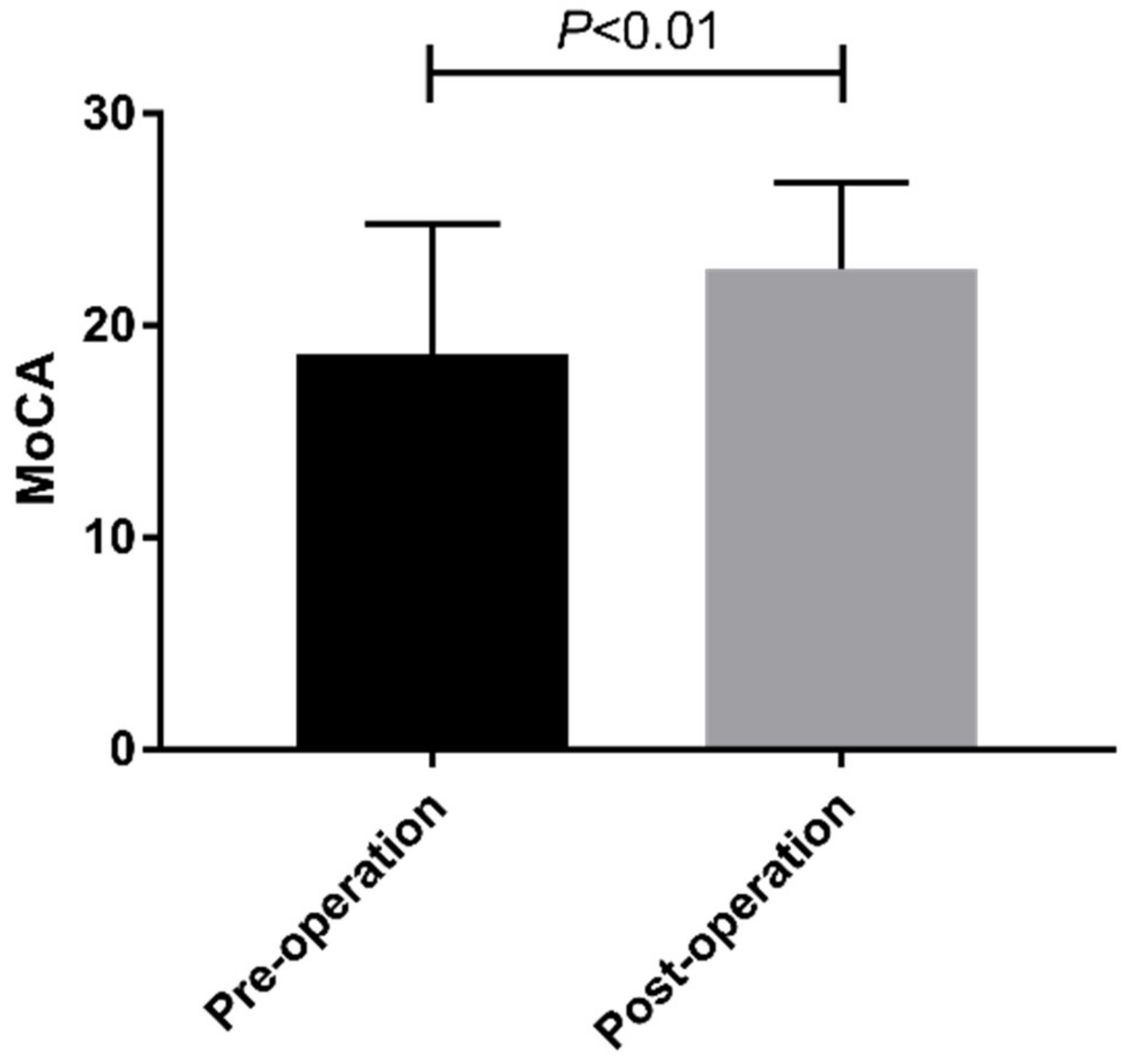 Brainsci 12 00759 g001
