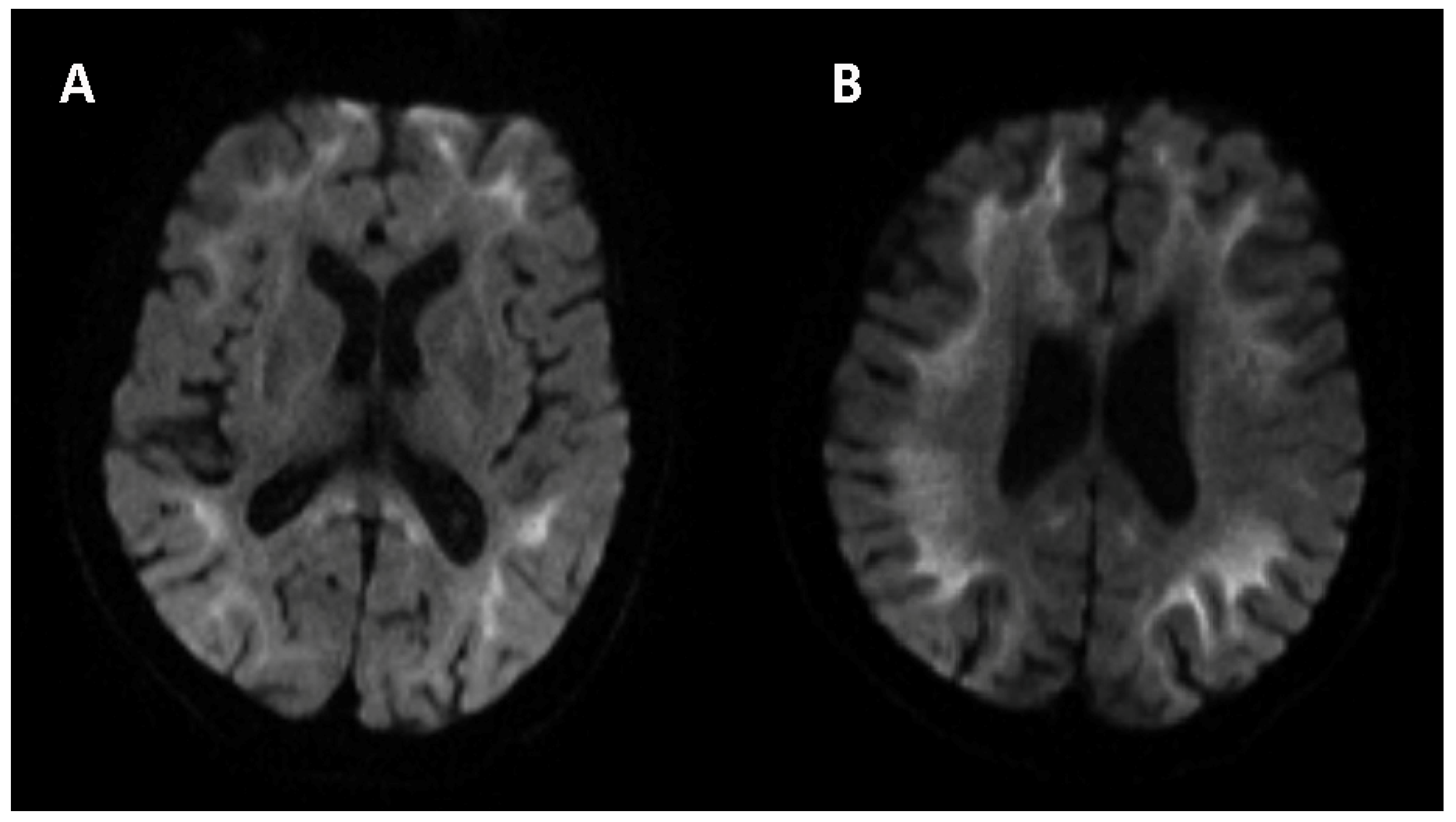 Brainsci 12 00782 g002 Brainsci 12 00782 g002