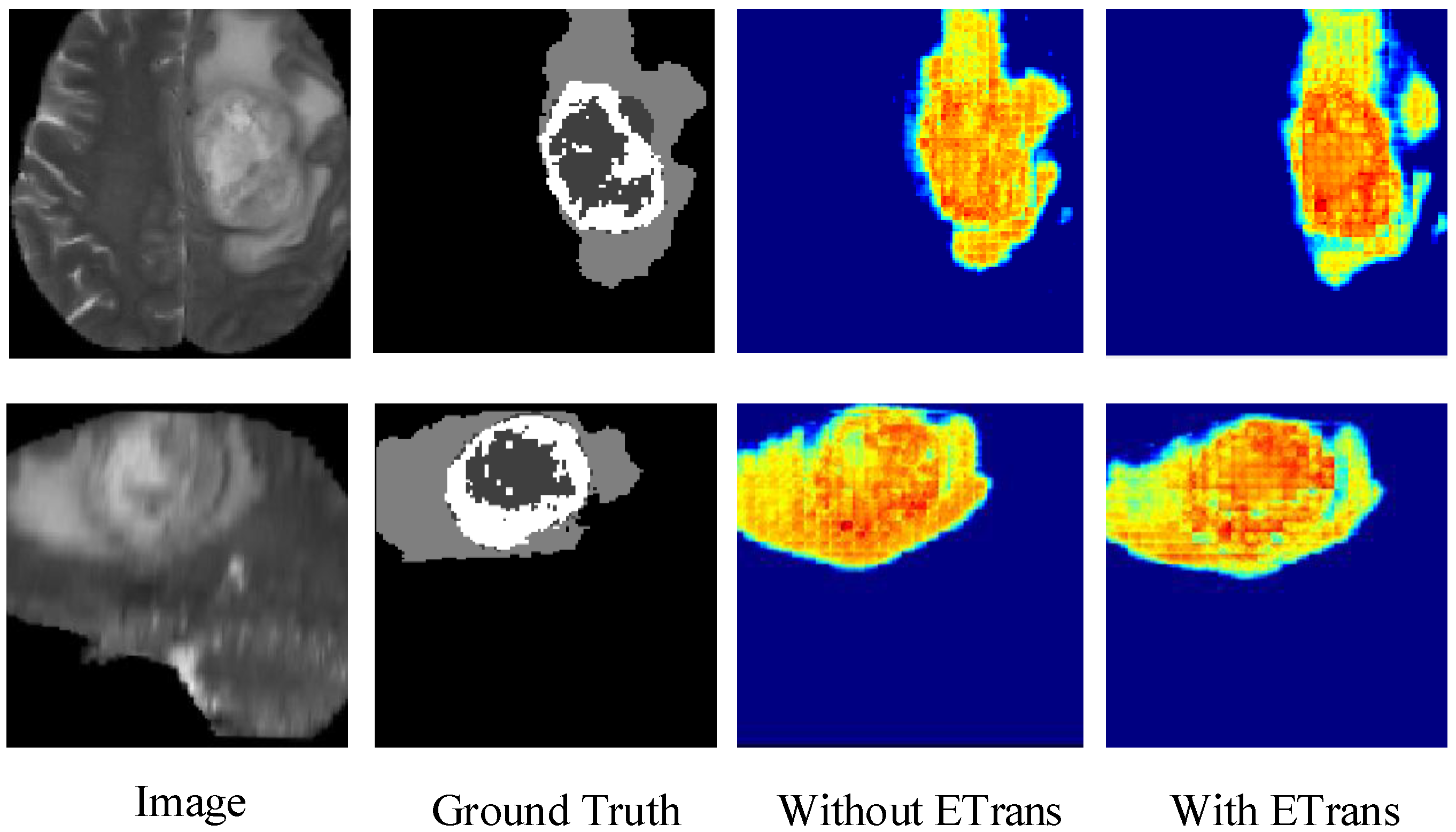 Brainsci 12 00797 g004