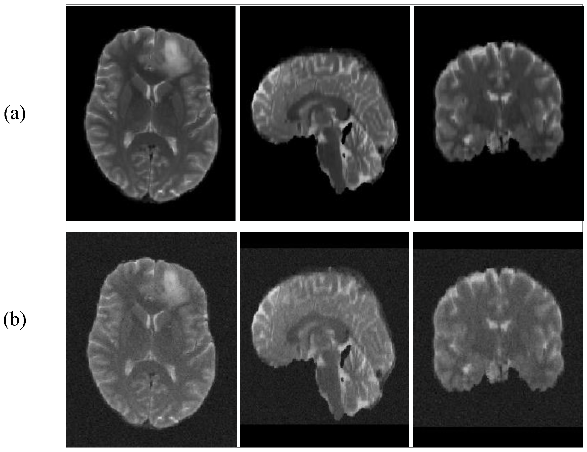 Brainsci 12 00797 g005