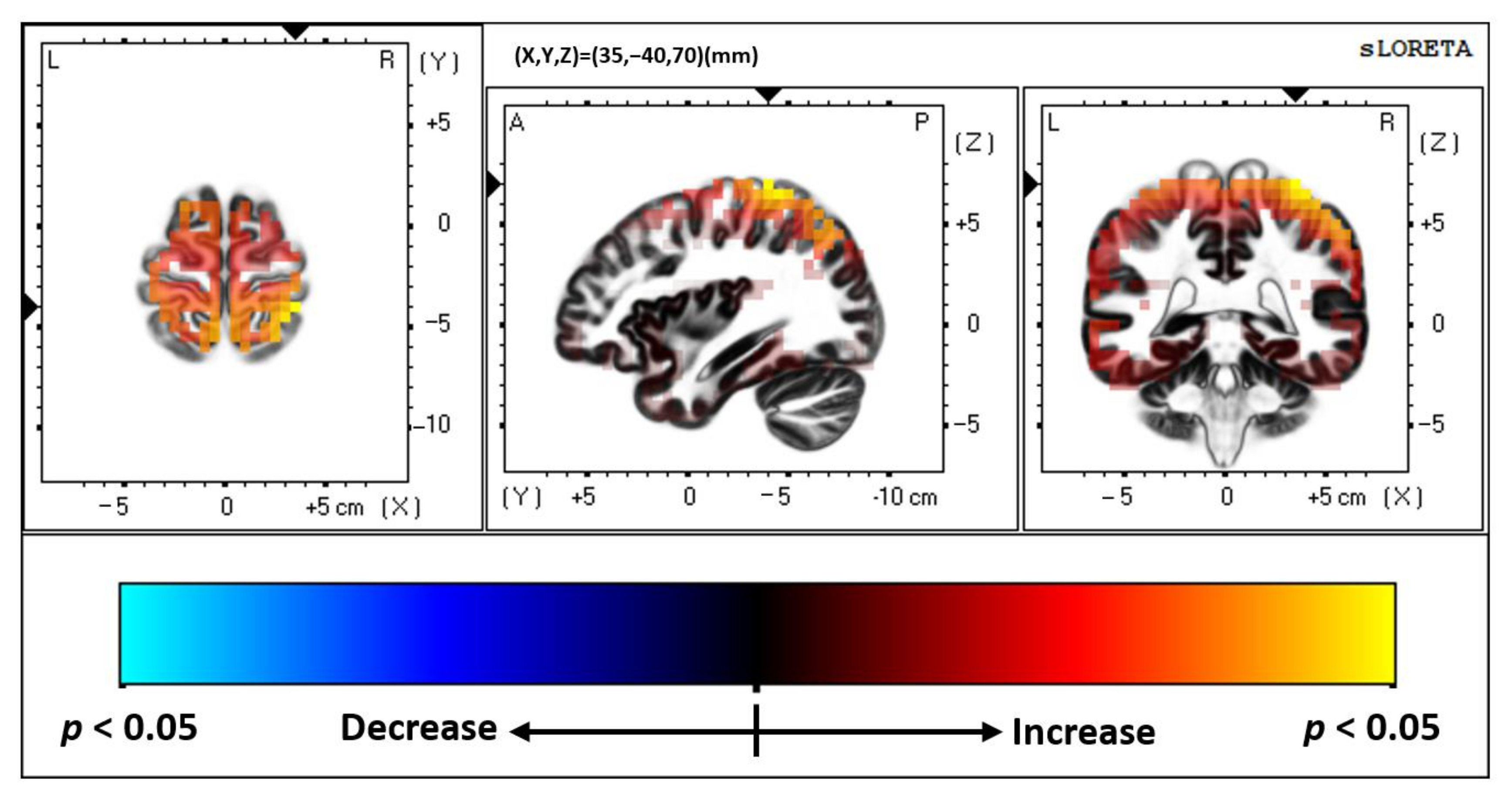 Brainsci 12 00809 g003