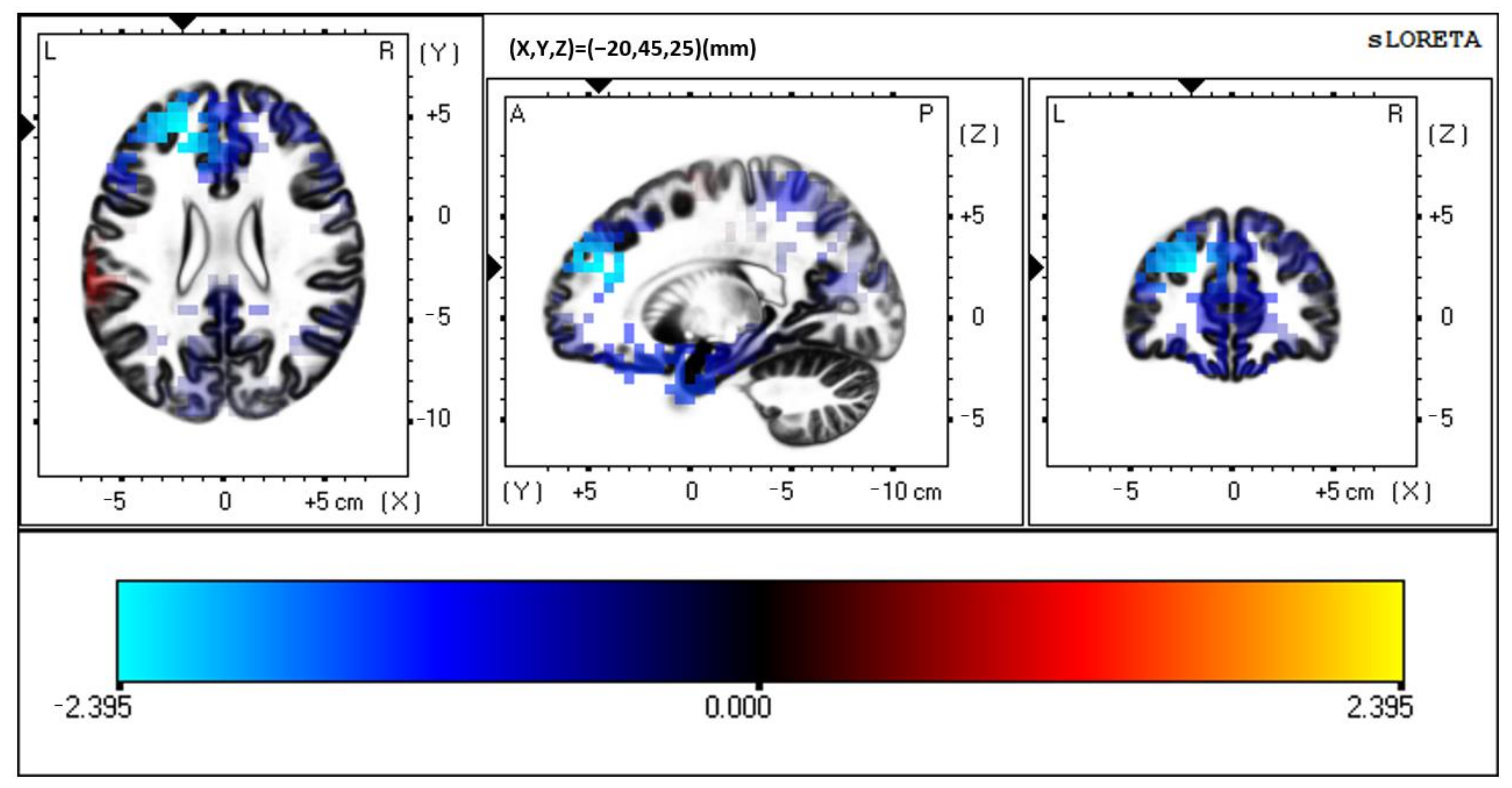 Brainsci 12 00809 g006