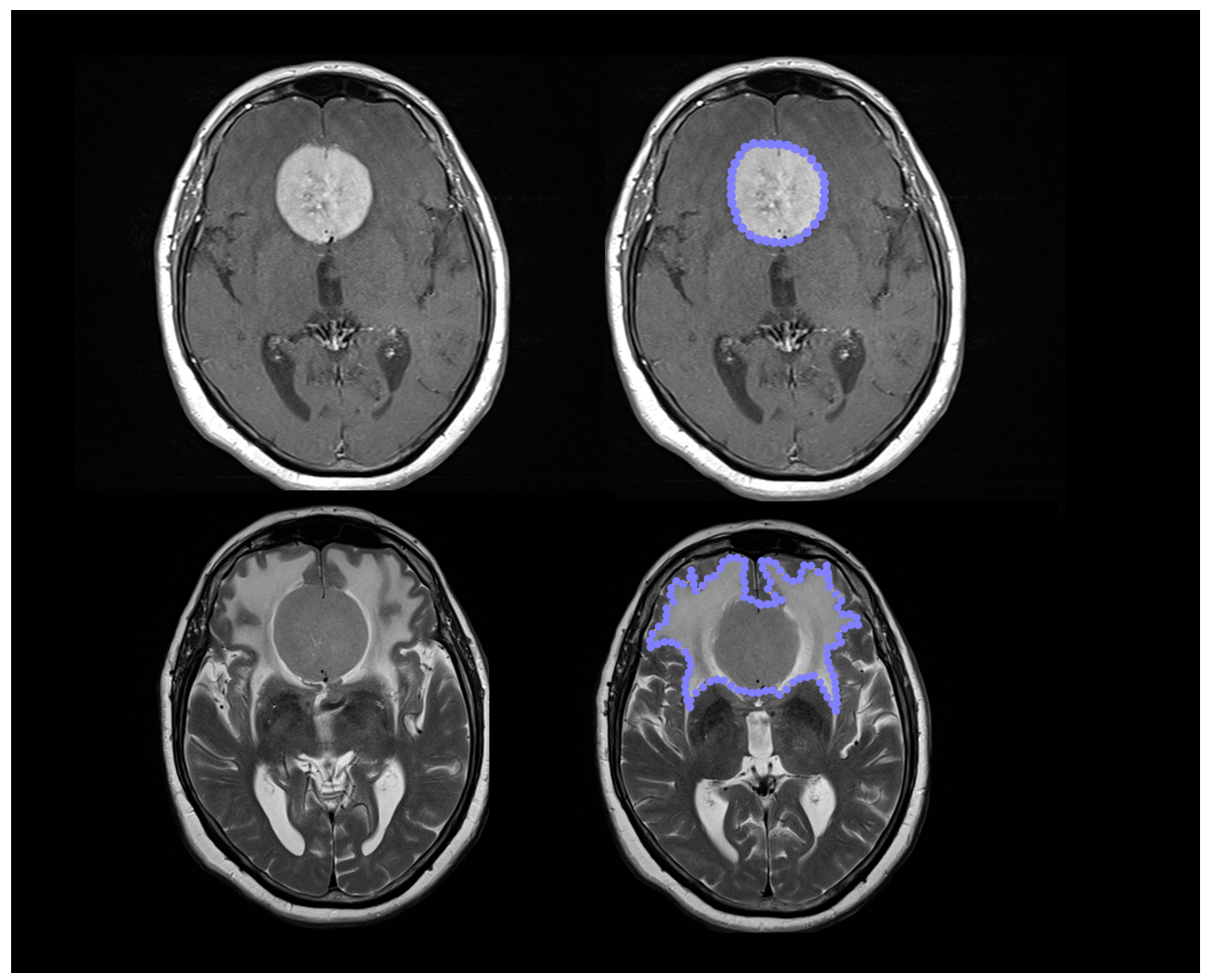 Brainsci 12 00817 g001