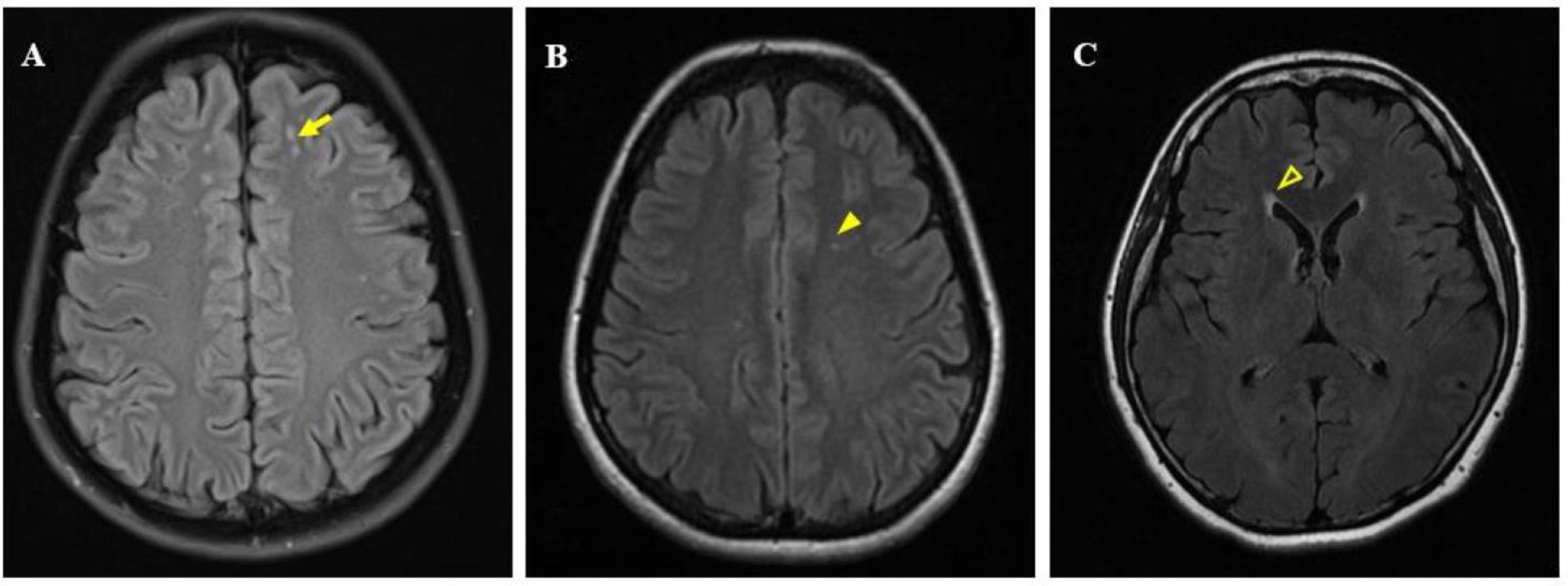 Brainsci 12 00884 g001
