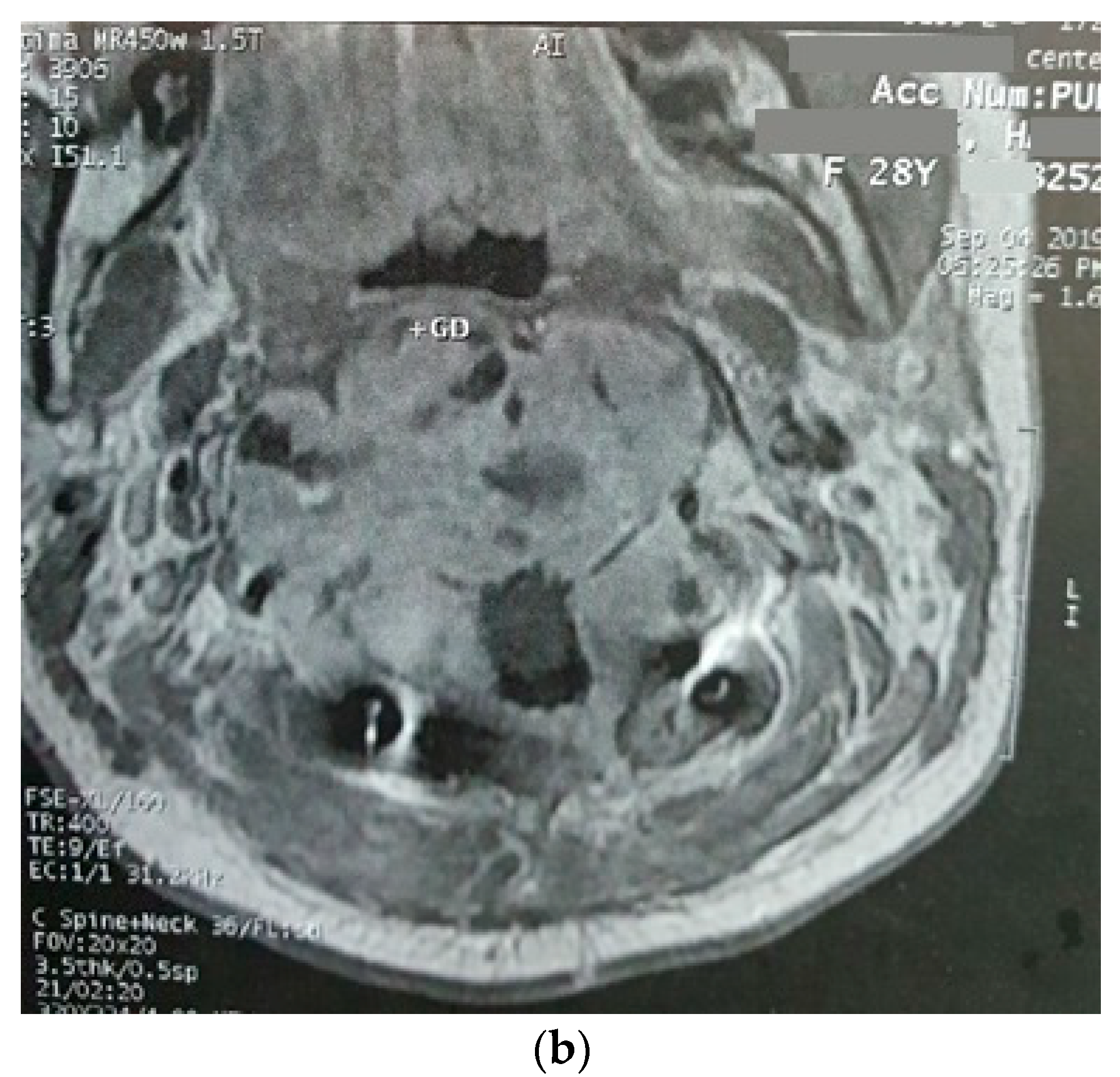 Brainsci 12 00958 g002b Brainsci 12 00958 g002b