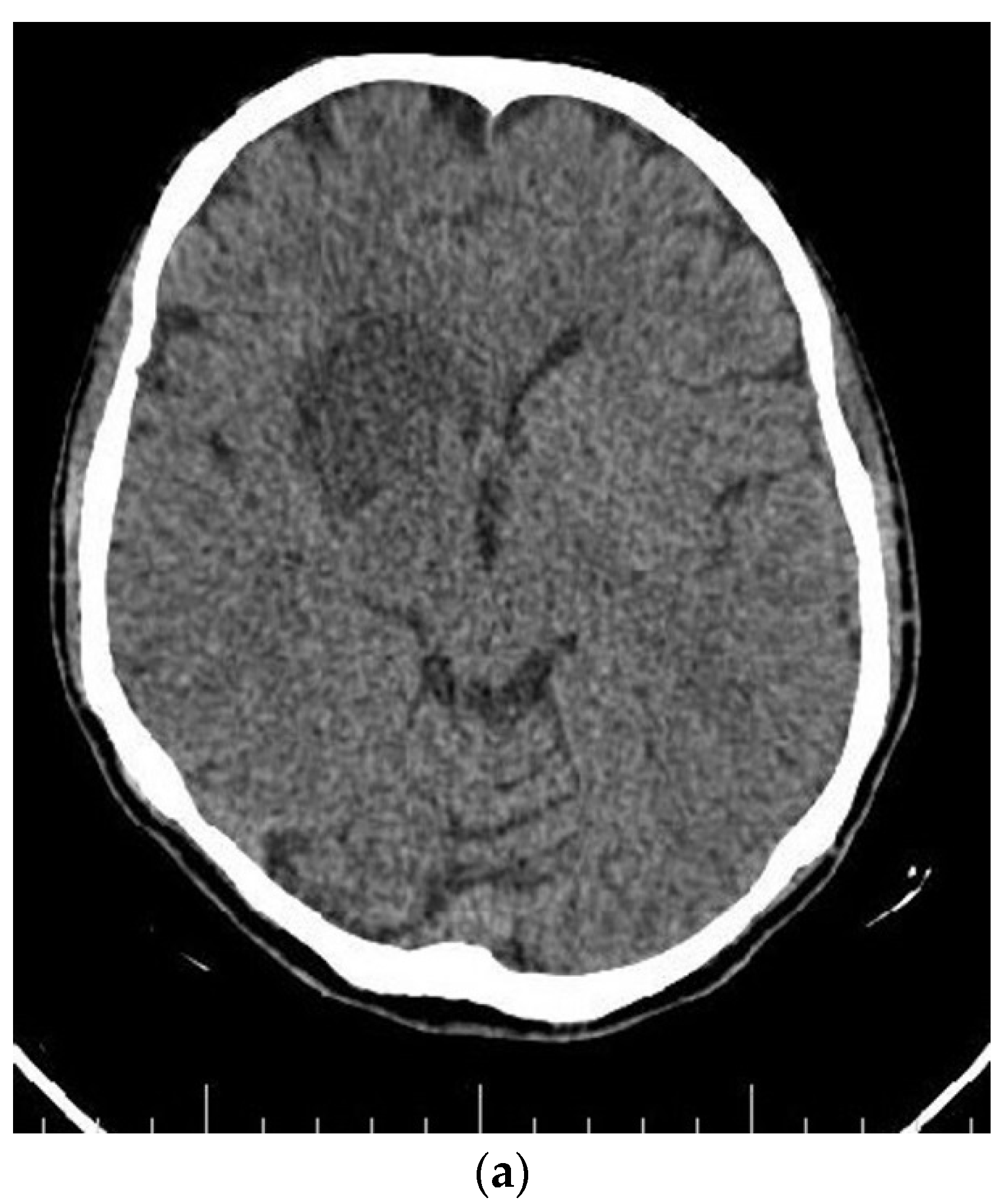 Brainsci 12 00958 g004a Brainsci 12 00958 g004a