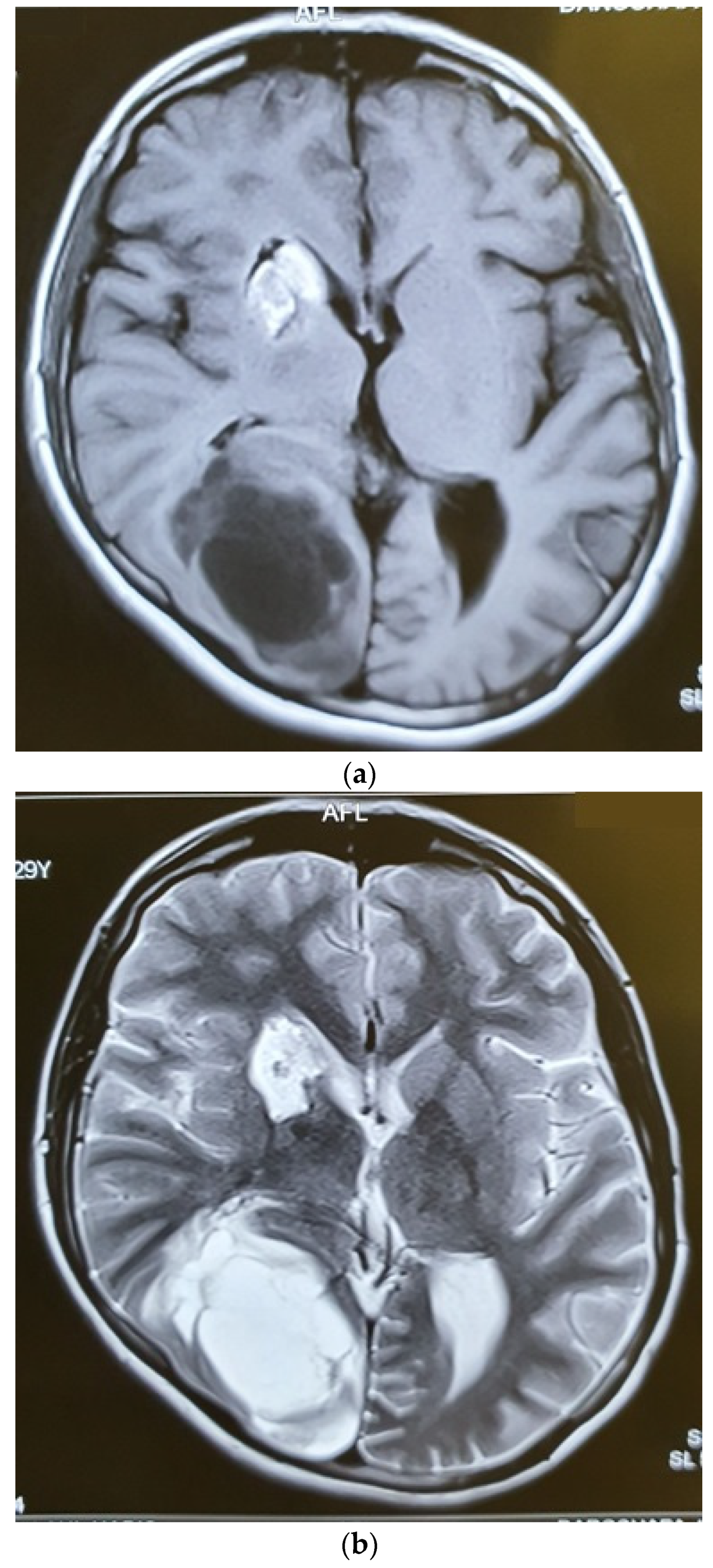 Brainsci 12 00958 g006a Brainsci 12 00958 g006a