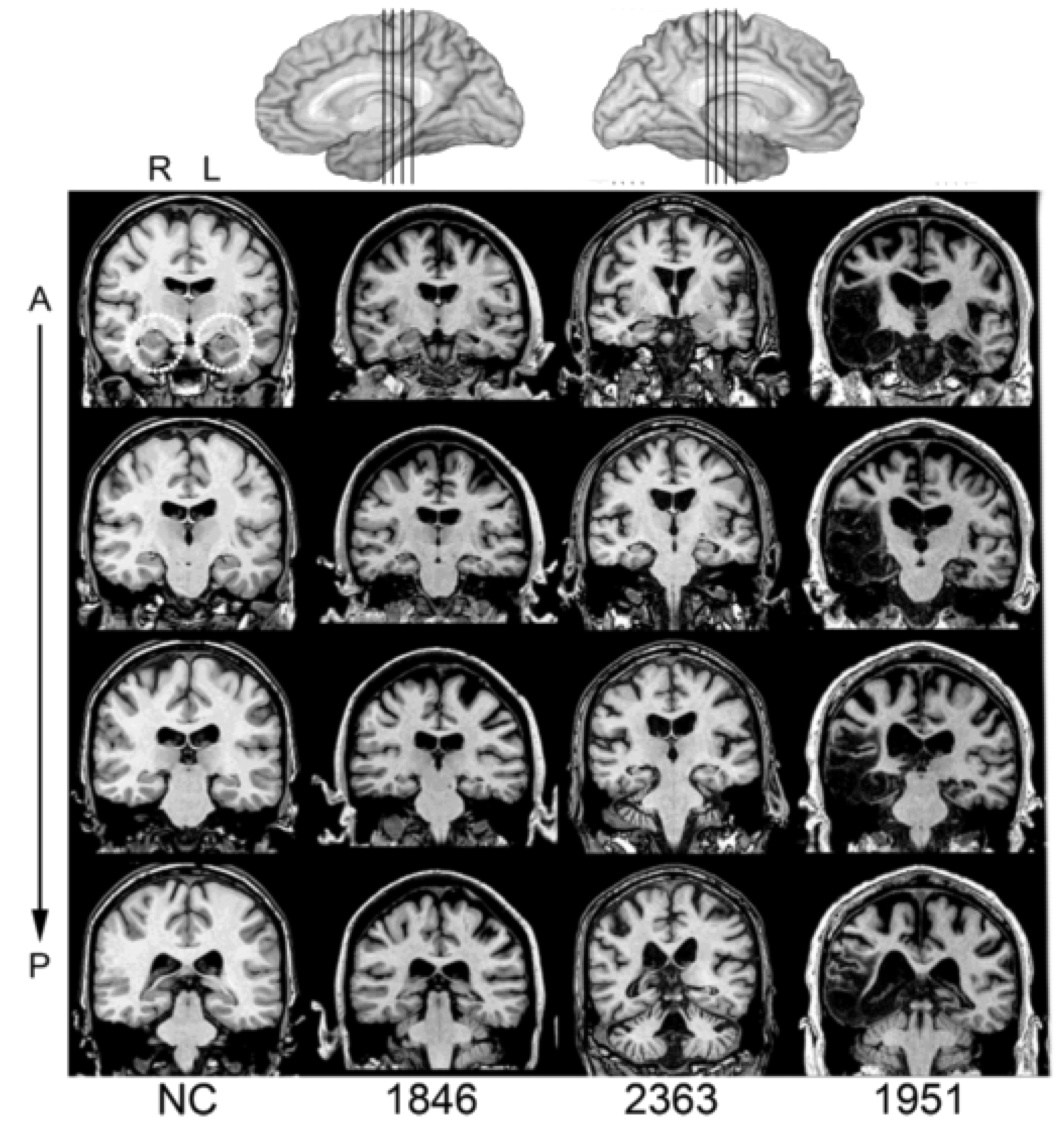 Brainsci 12 01082 g001