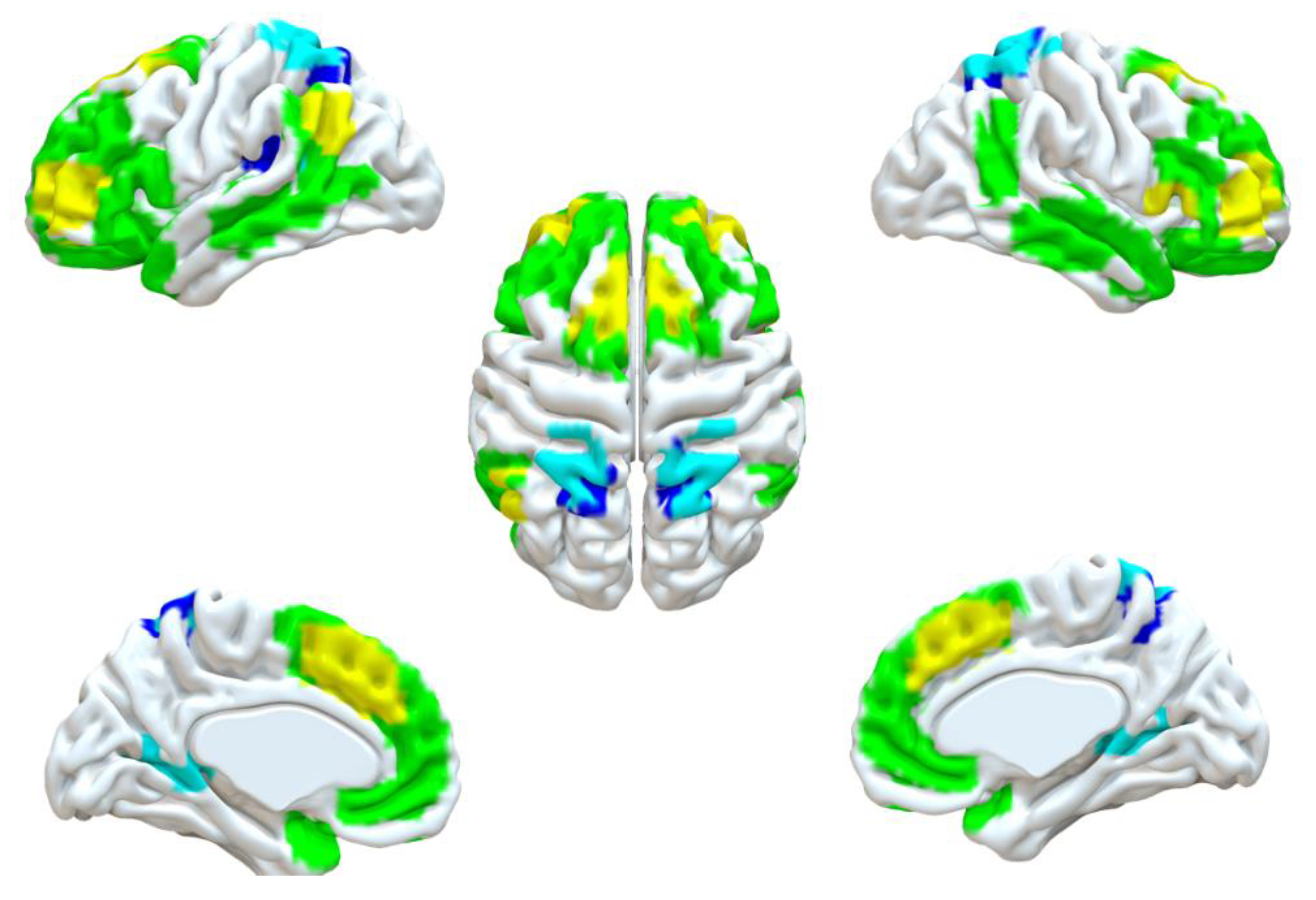 Brainsci 12 01112 g002