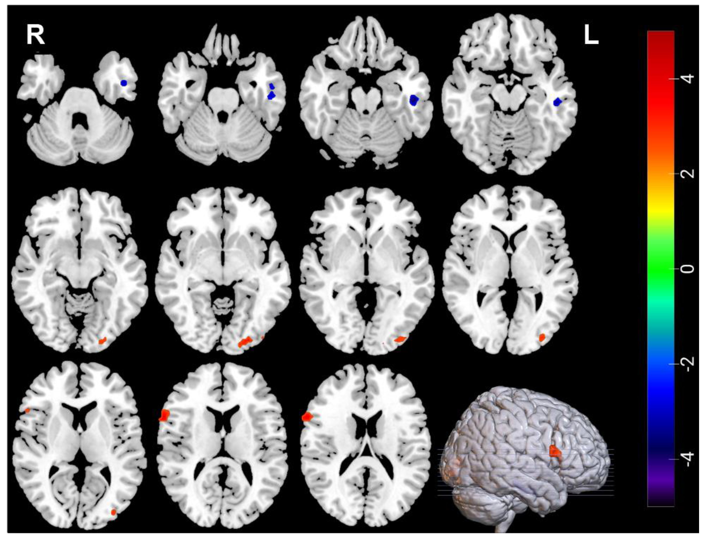 Brainsci 12 01121 g002