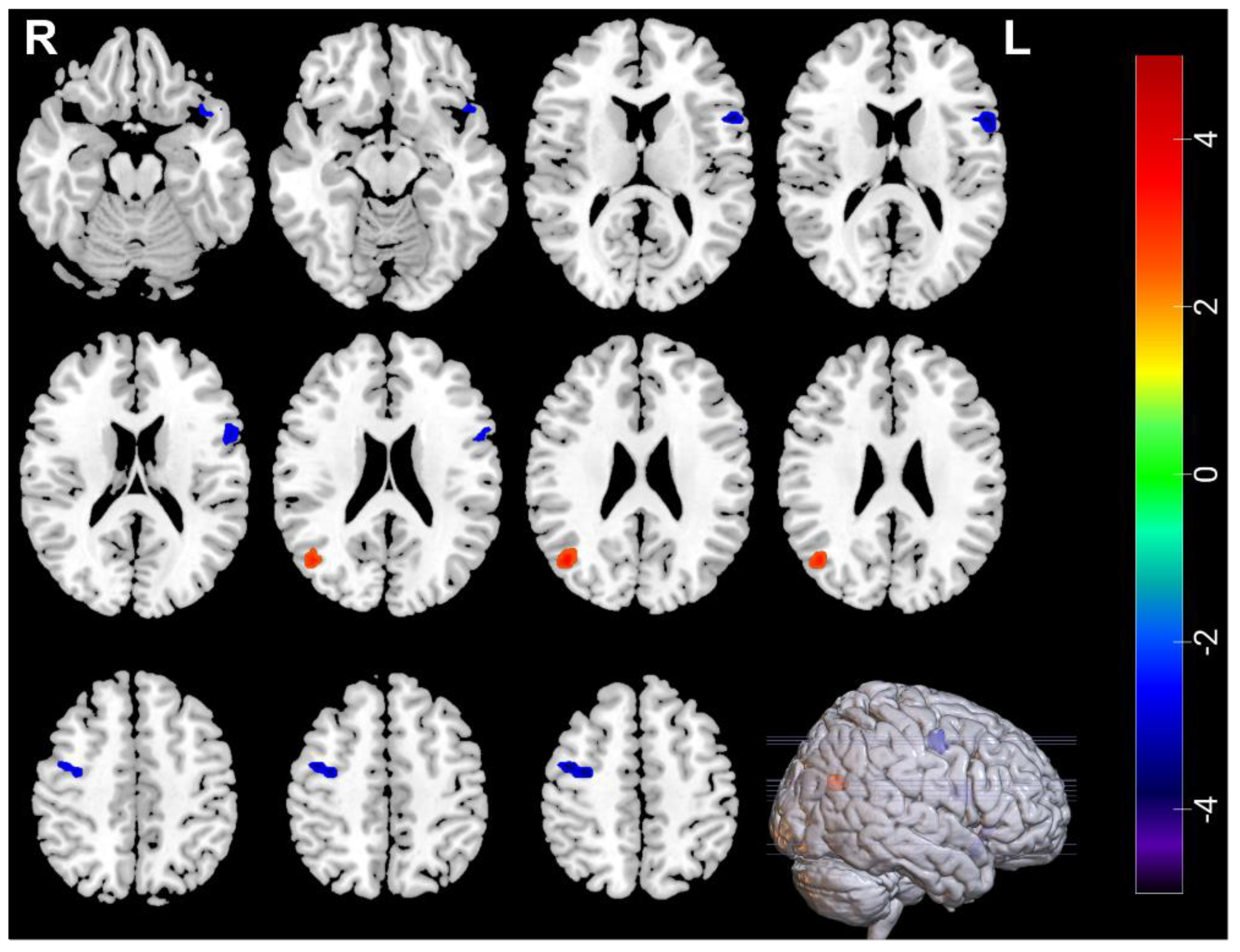 Brainsci 12 01121 g003