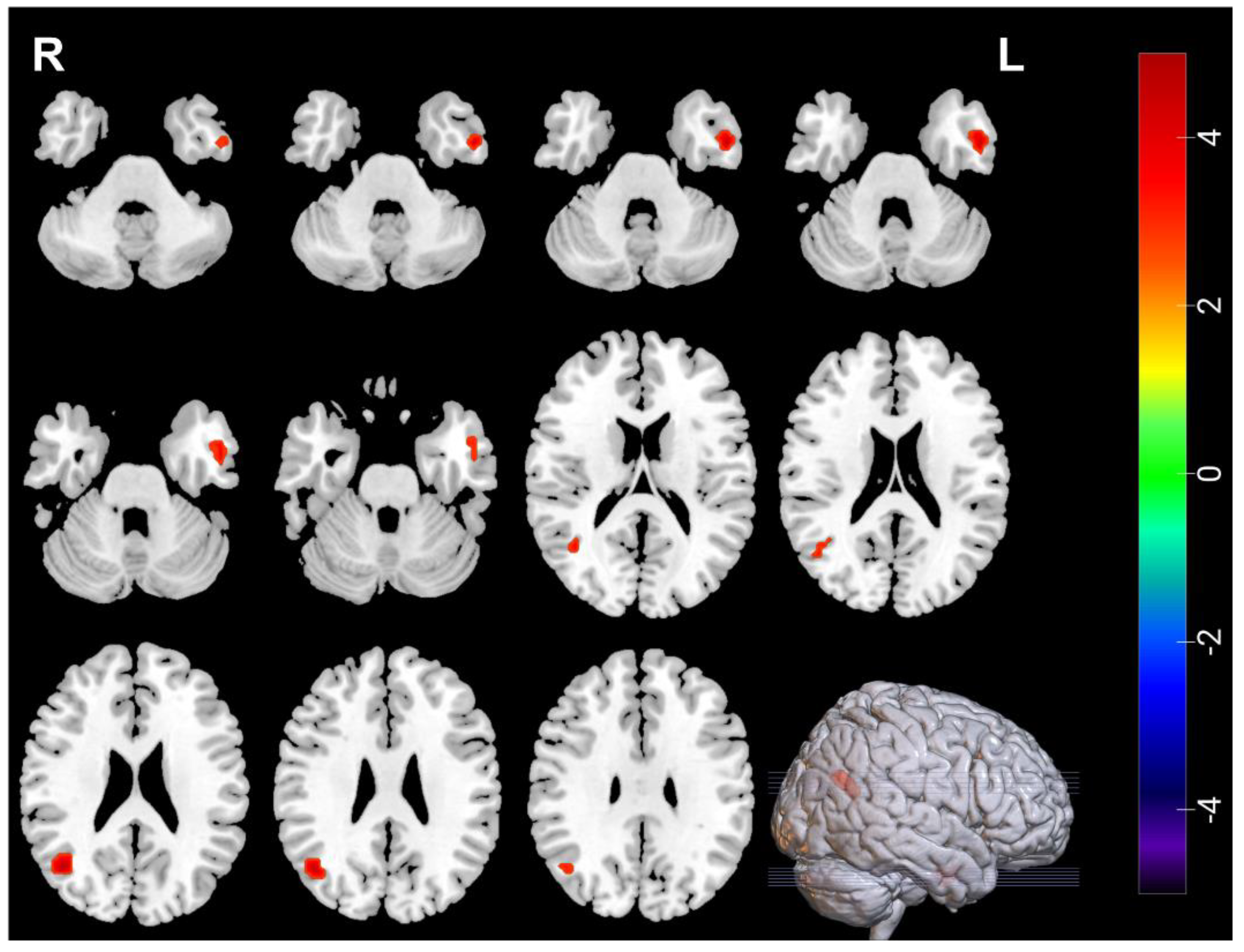 Brainsci 12 01121 g004