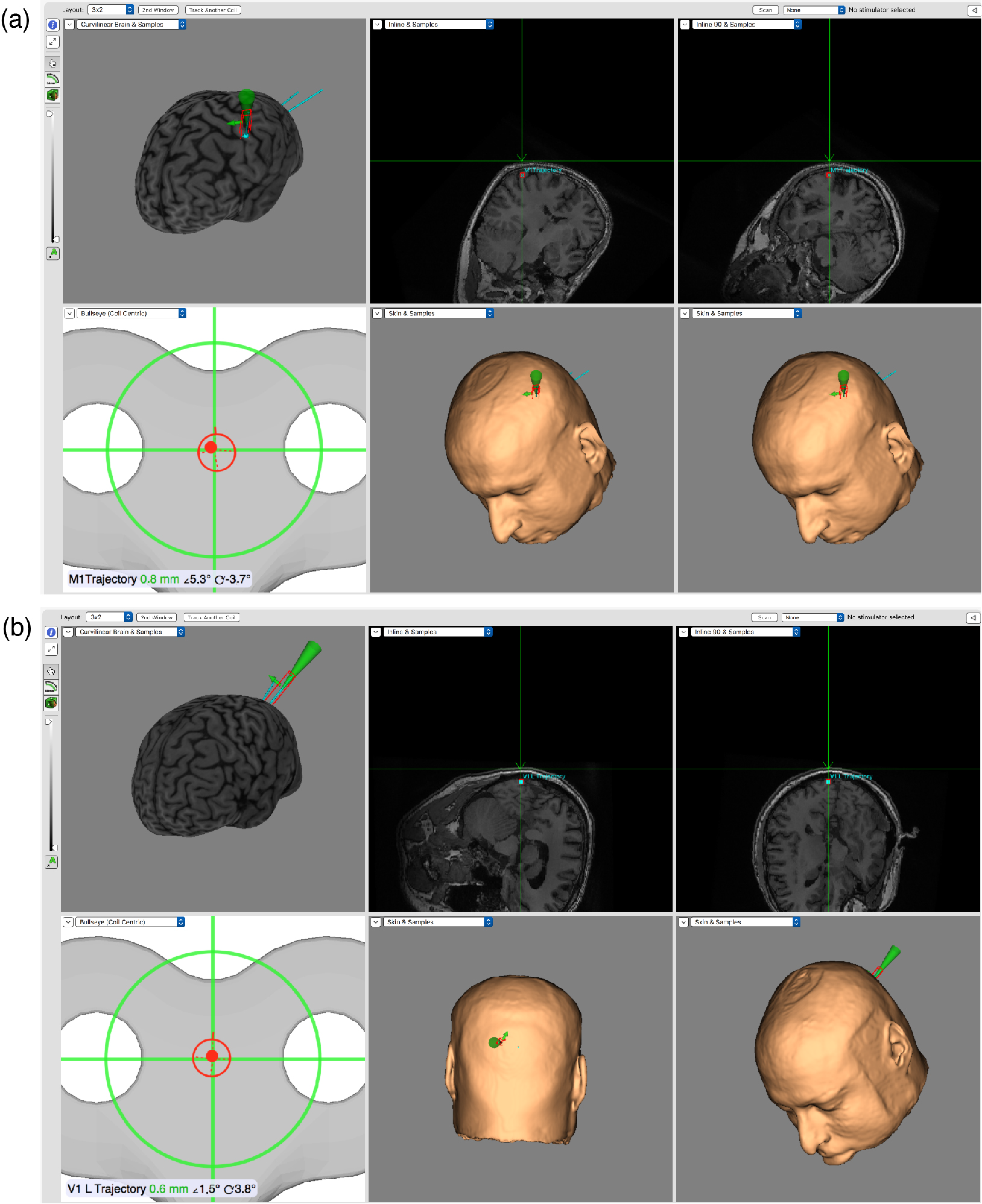 Brainsci 12 01241 g003