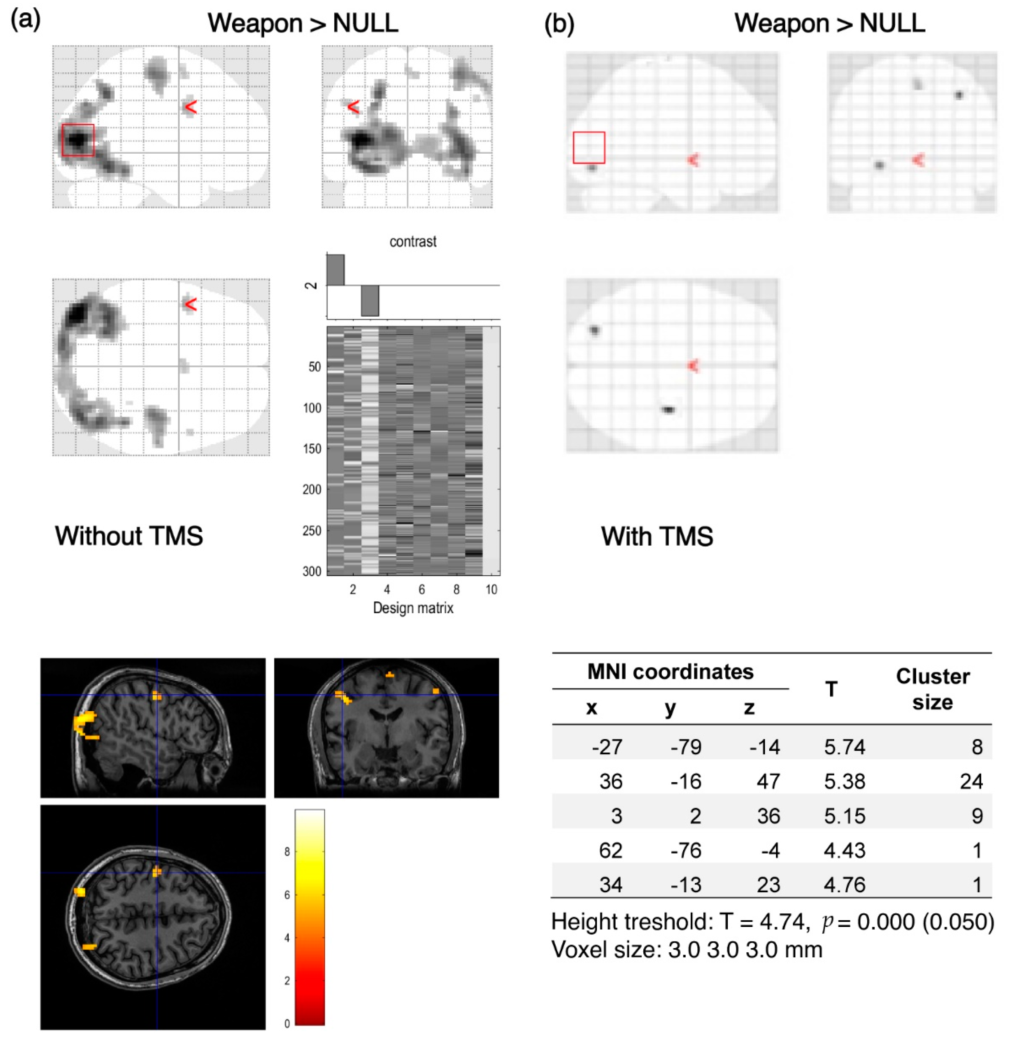 Brainsci 12 01241 g005