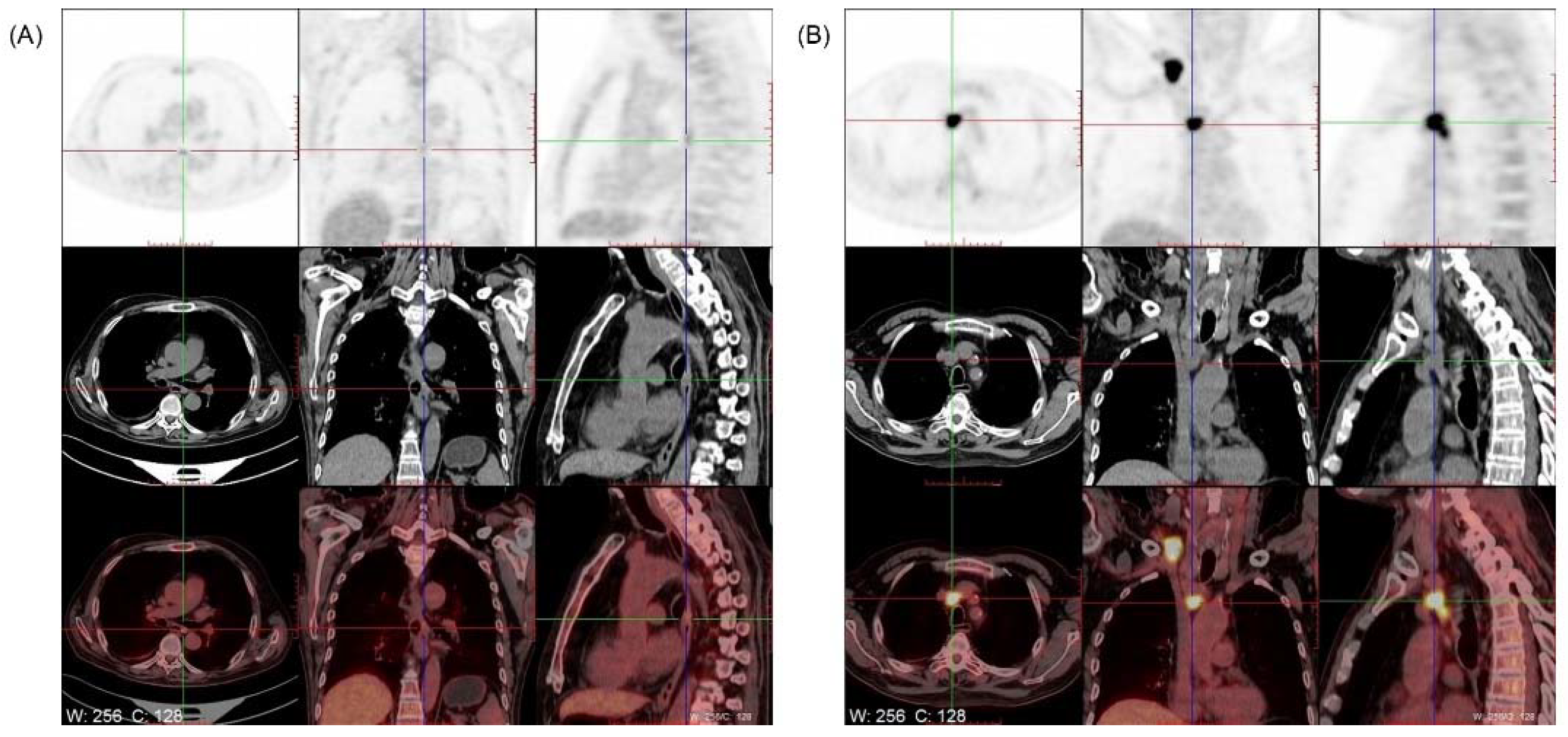 Brainsci 12 01242 g003