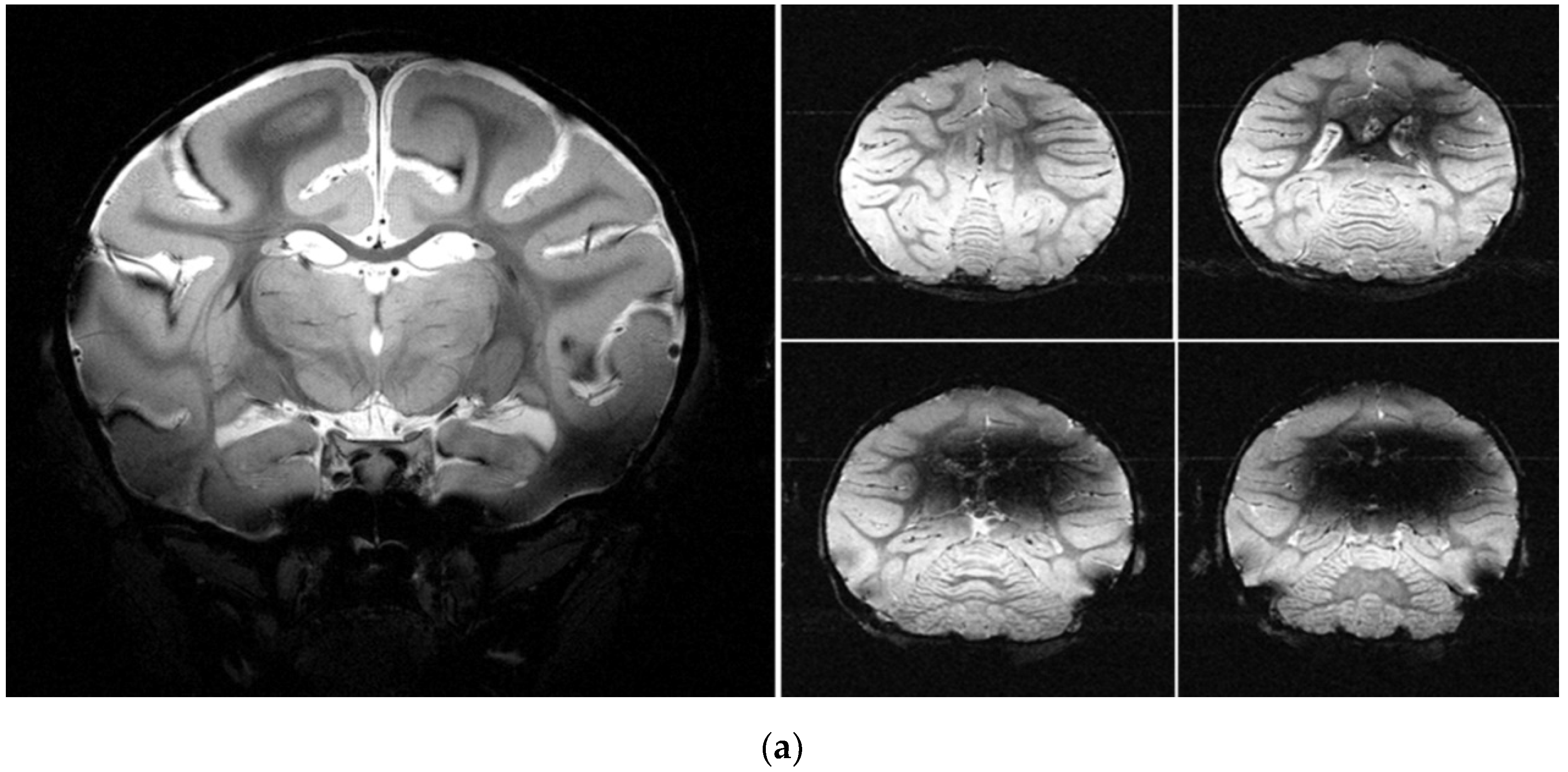 Brainsci 12 01243 g005a