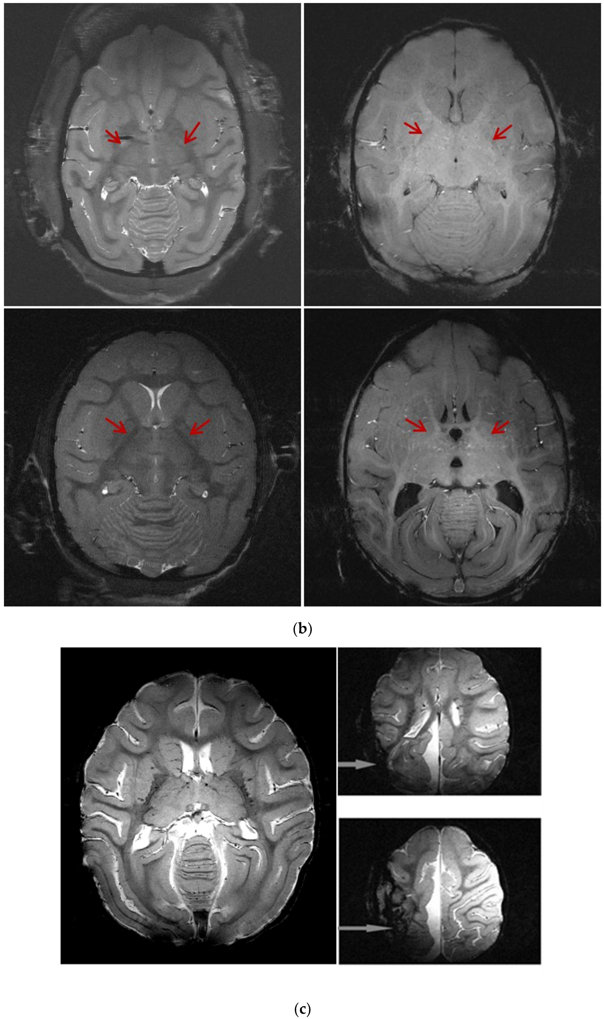Brainsci 12 01243 g005b