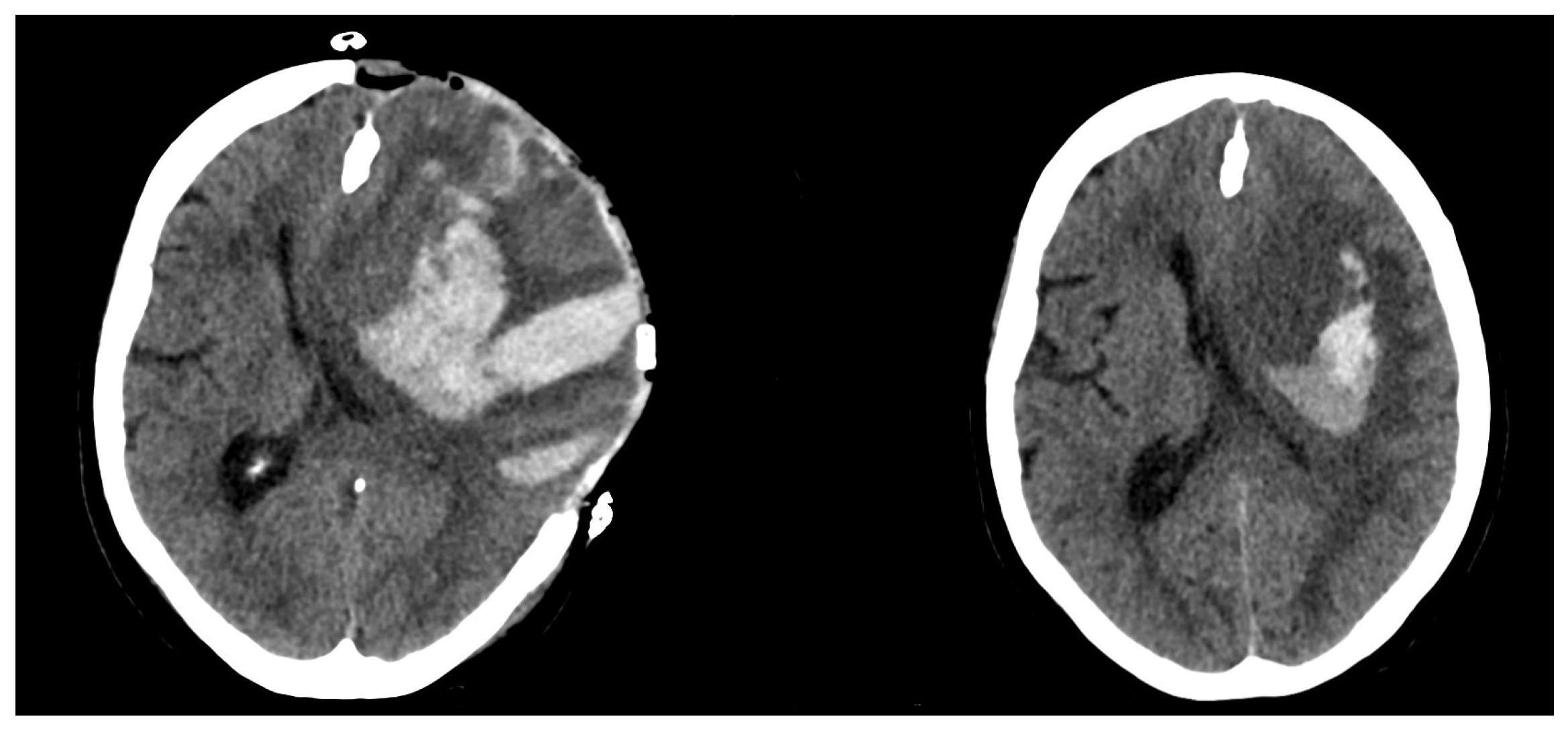 Brainsci 12 01298 g001