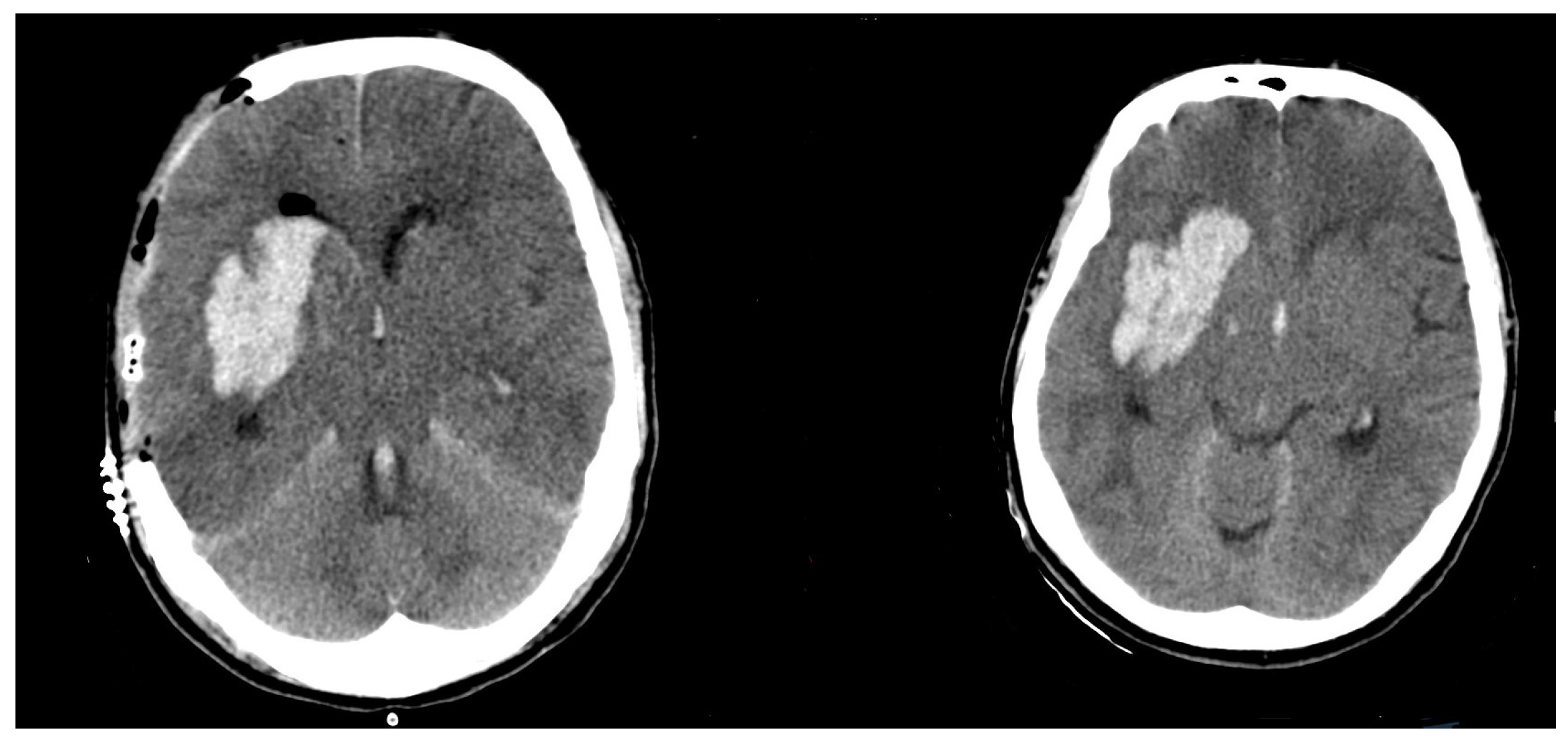 Brainsci 12 01298 g002