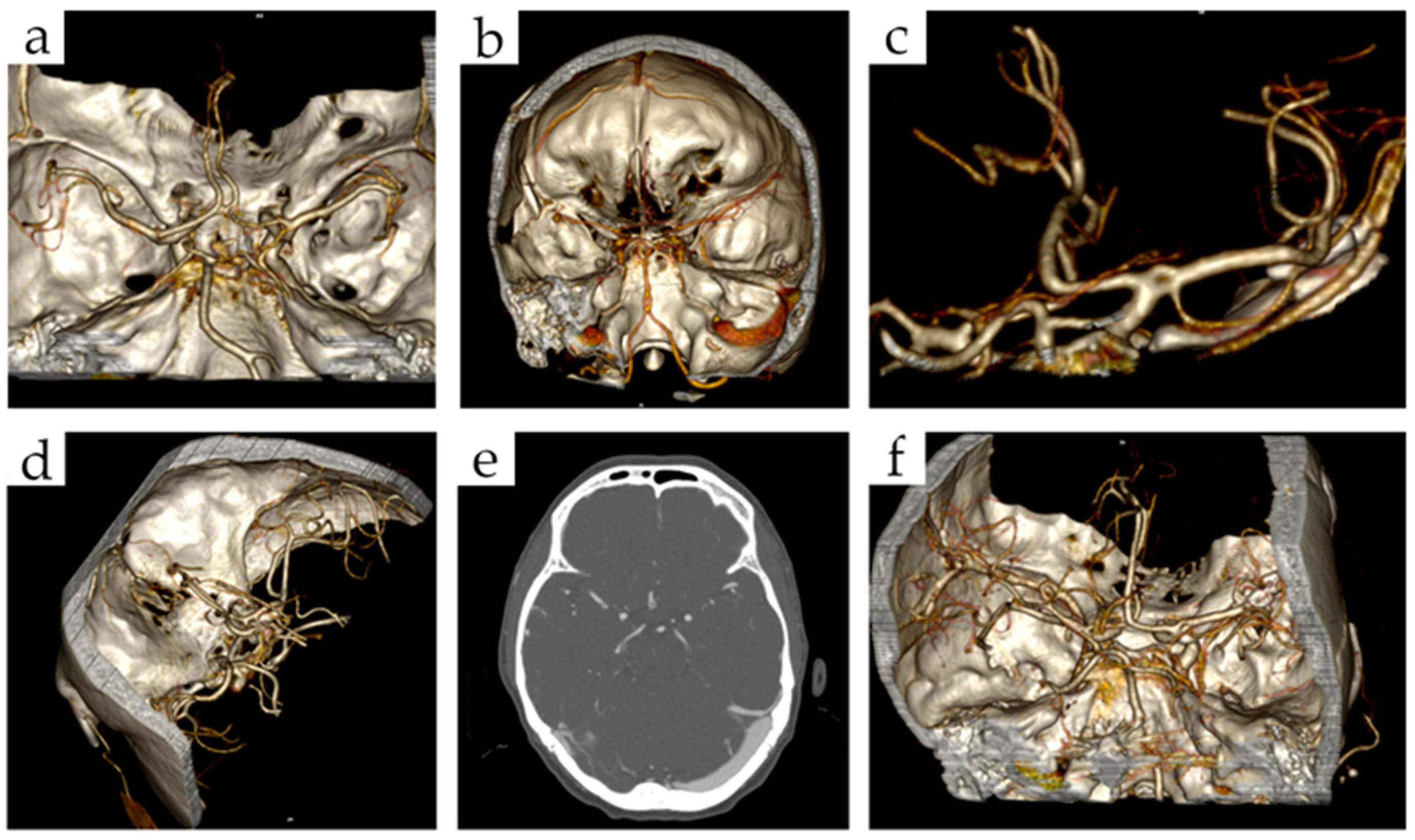Brainsci 12 01310 g001