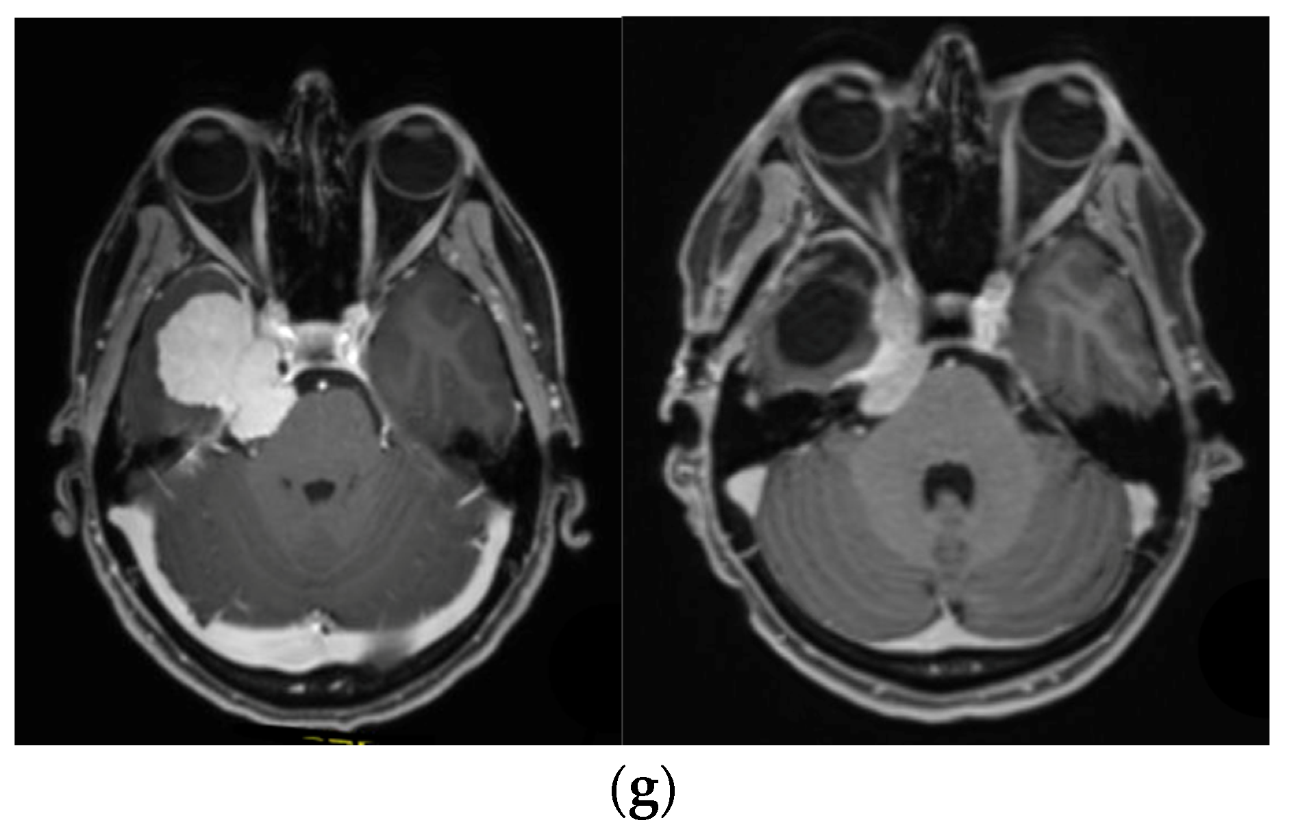 Brainsci 12 01326 g003d