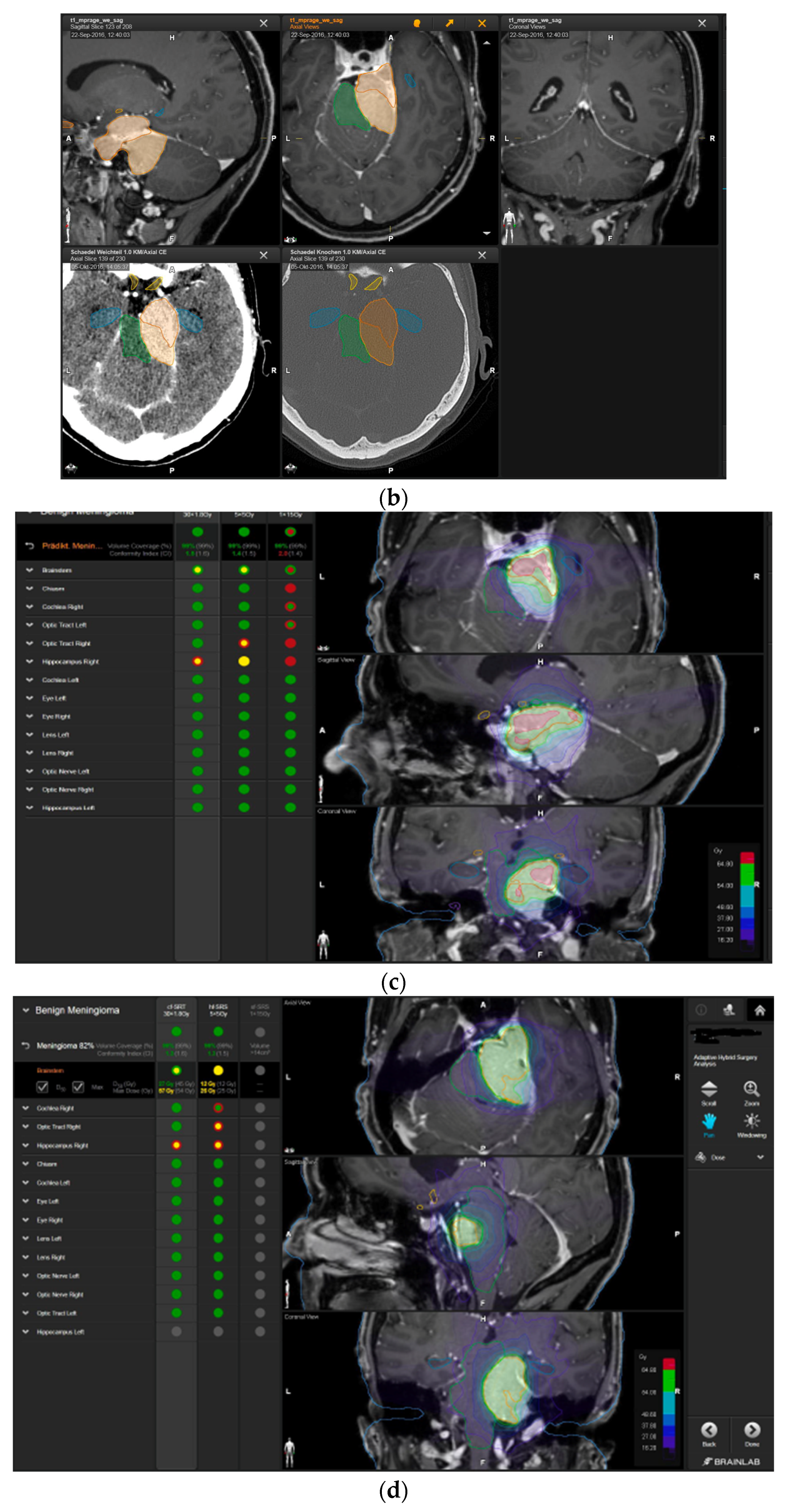 Brainsci 12 01326 g004b