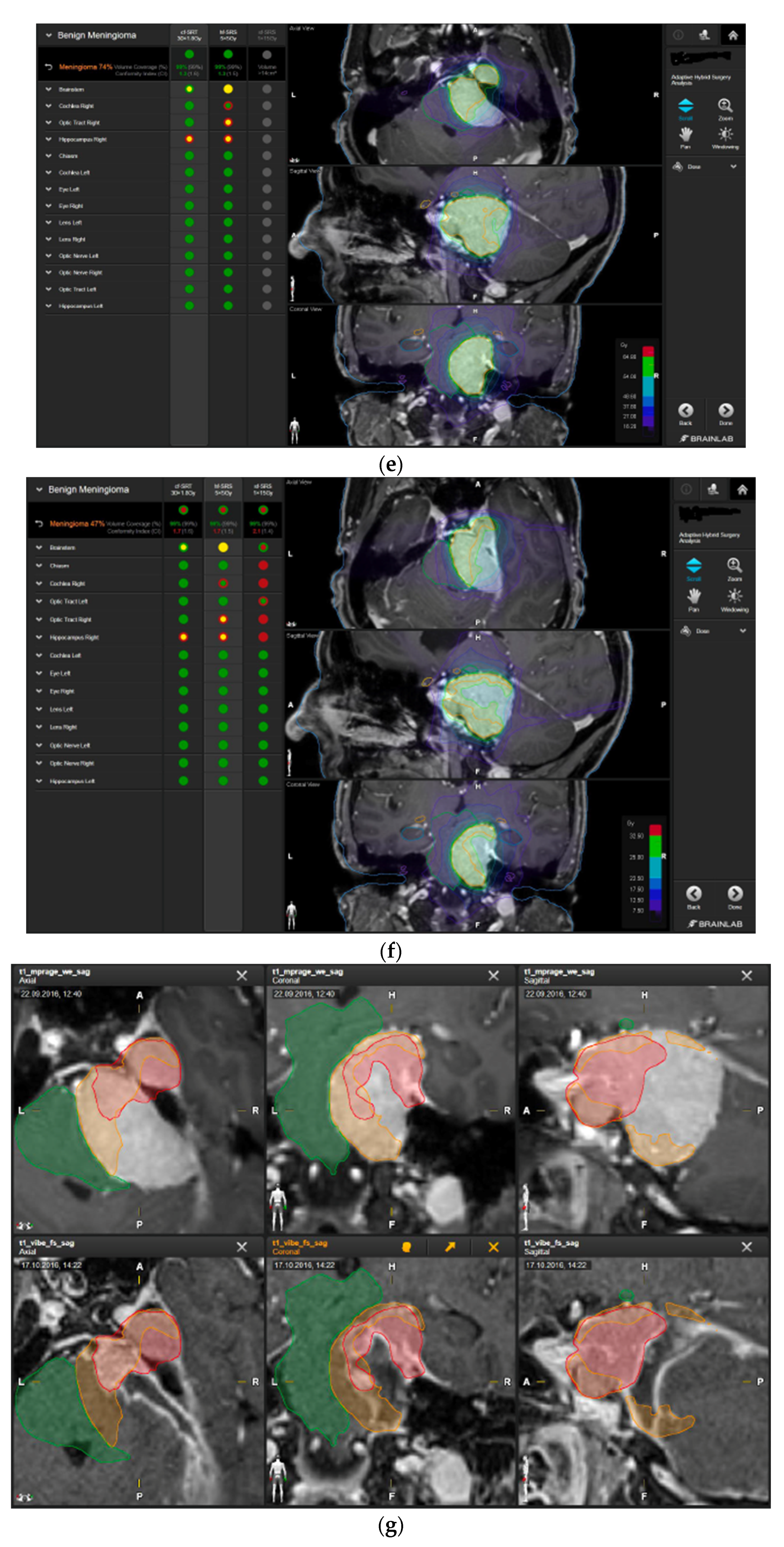 Brainsci 12 01326 g004c
