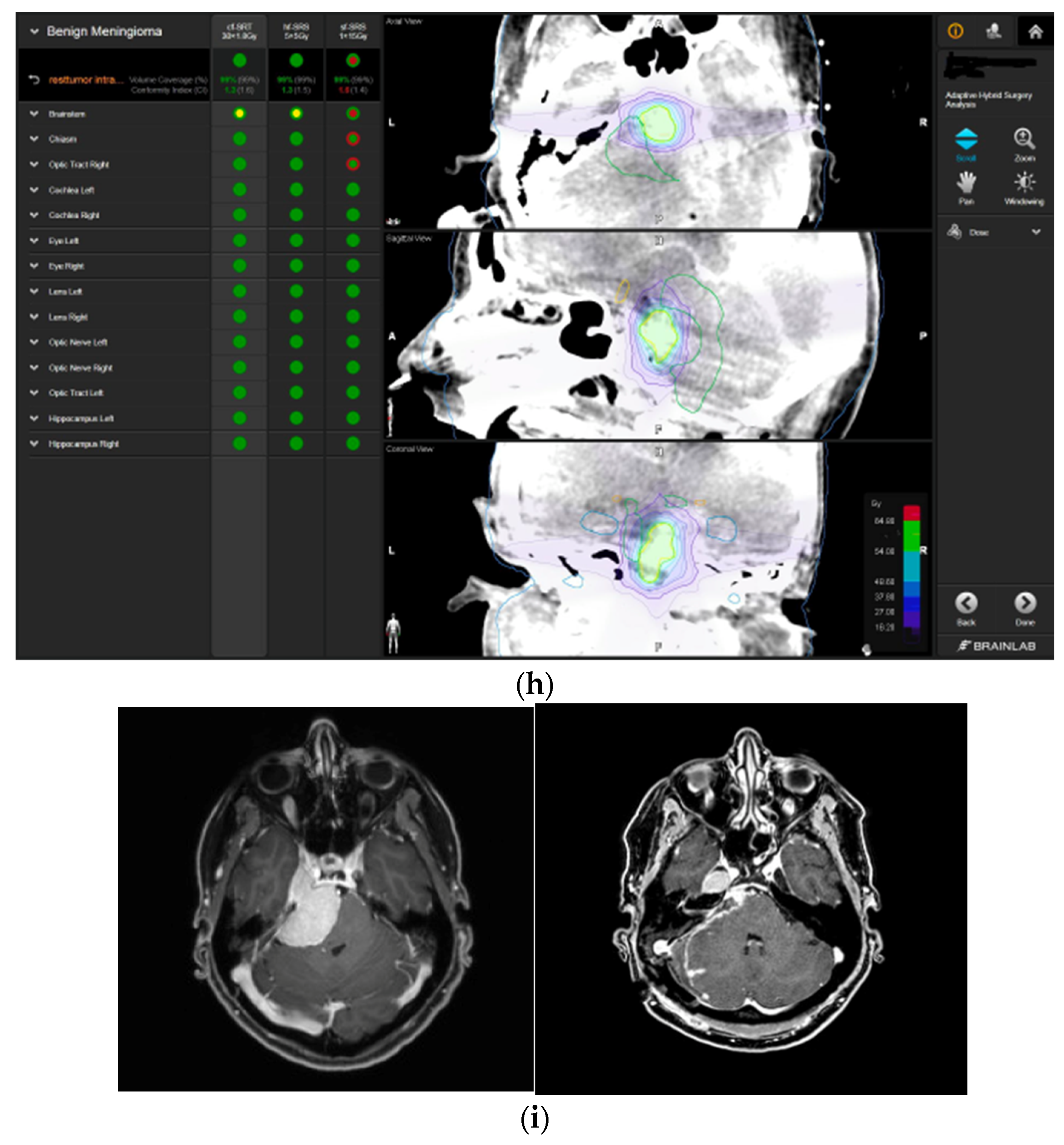 Brainsci 12 01326 g004d