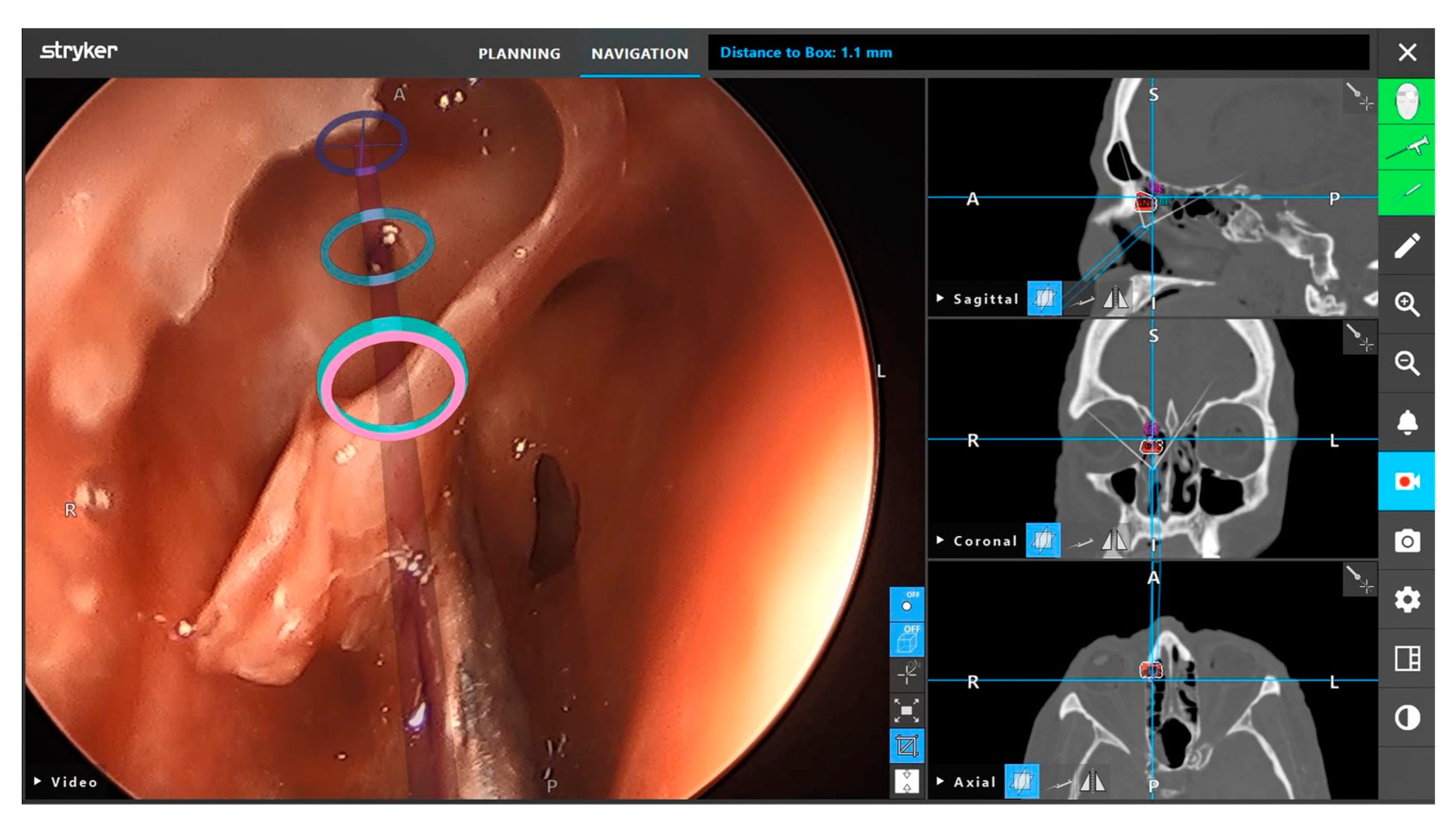 Brainsci 12 01337 g005 Brainsci 12 01337 g005