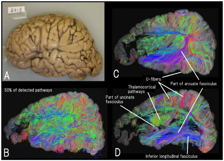 Brainsci 12 01366 g002
