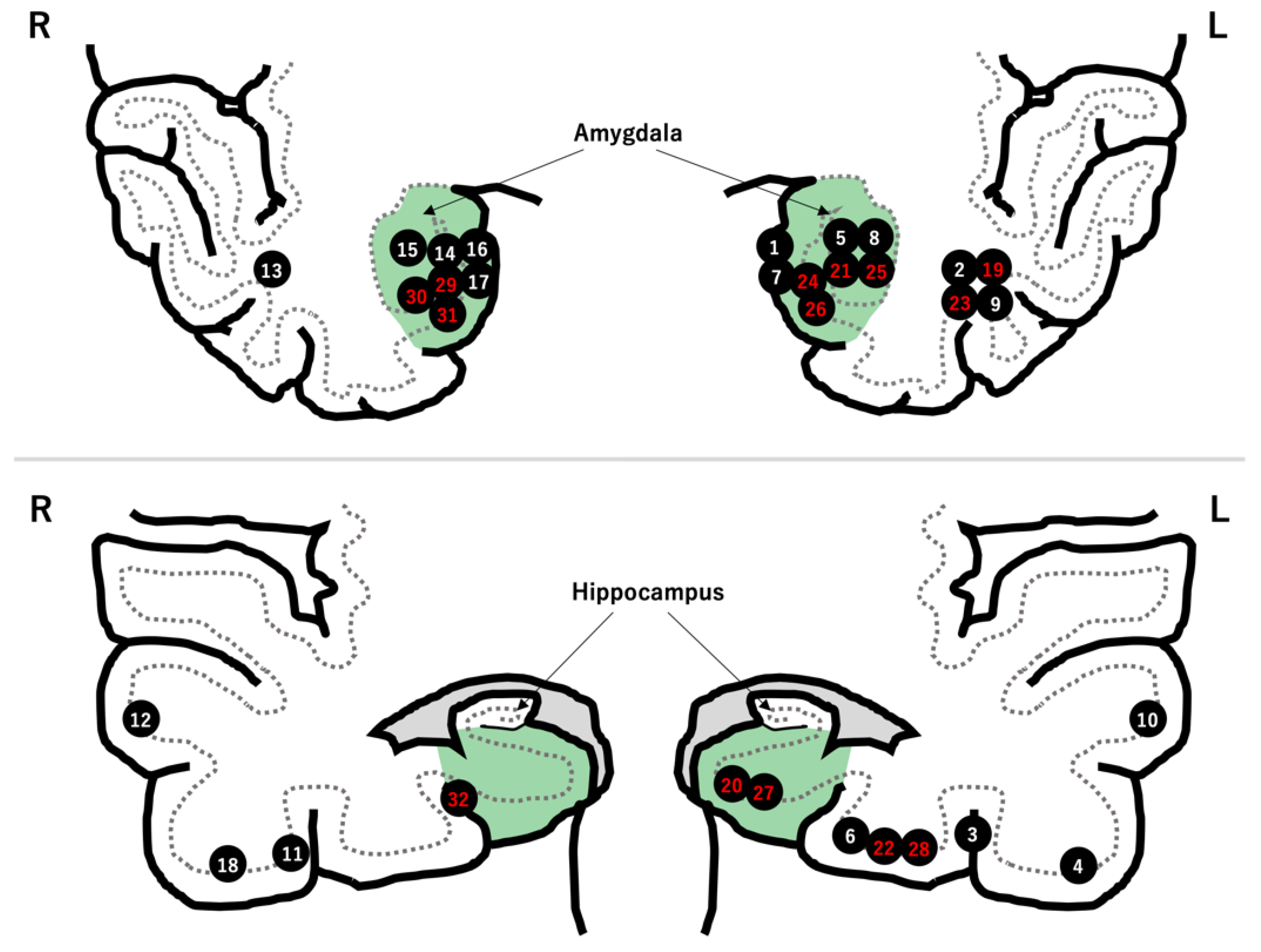 Brainsci 12 01381 g001